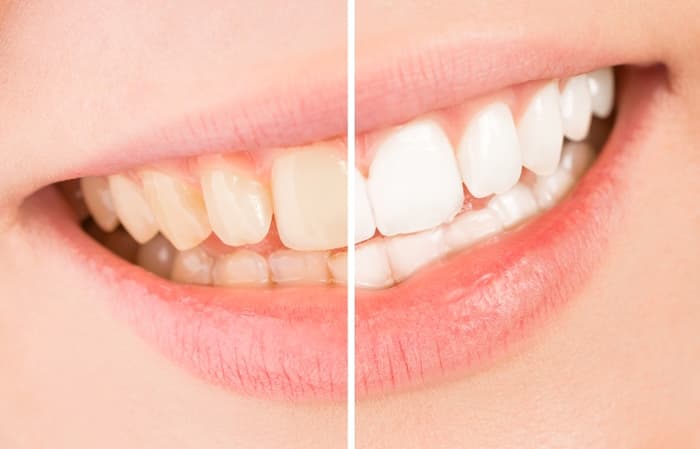 汚れの落としやすさの評価|おすすめ歯ブラシ