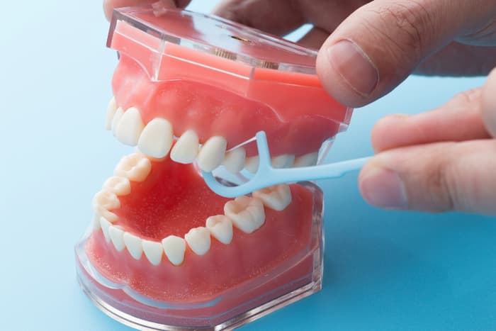 歯垢の取りやすさ|おすすめデンタルフロス