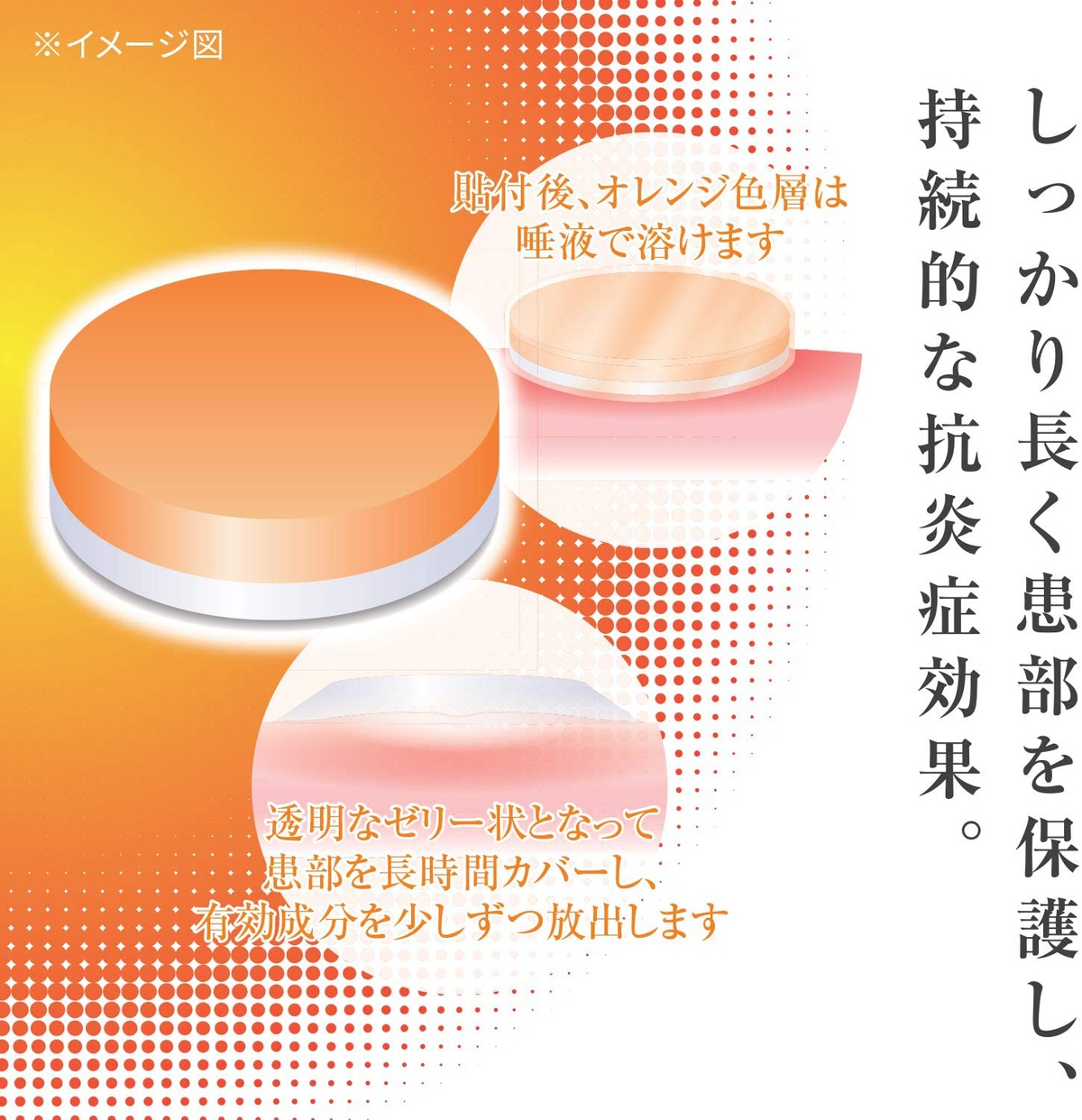 佐藤製薬(sato) アフタッチAの商品画像2 