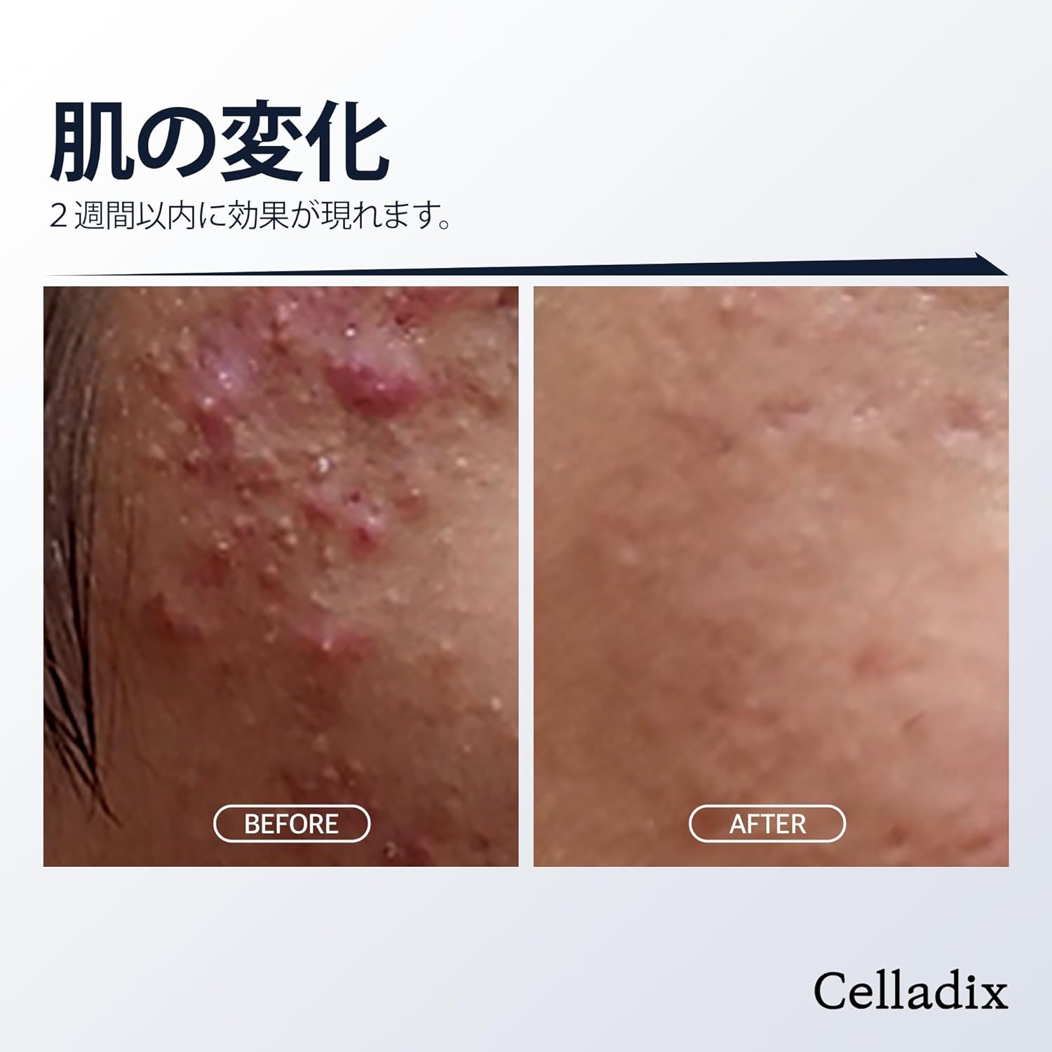 Celladix(セラディックス) セバムリバランシングRX131アンプルの商品画像3 