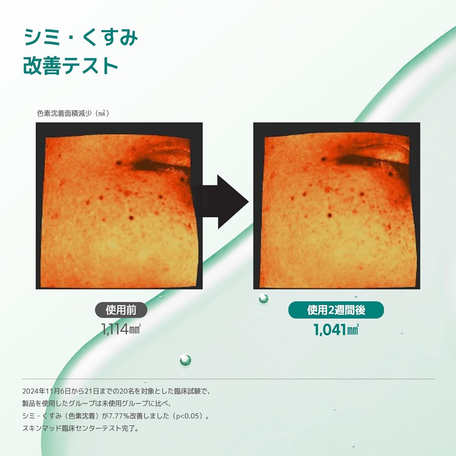 Luvum(ラビューム) グリーンシトラスビタミンCセラムの商品画像3 