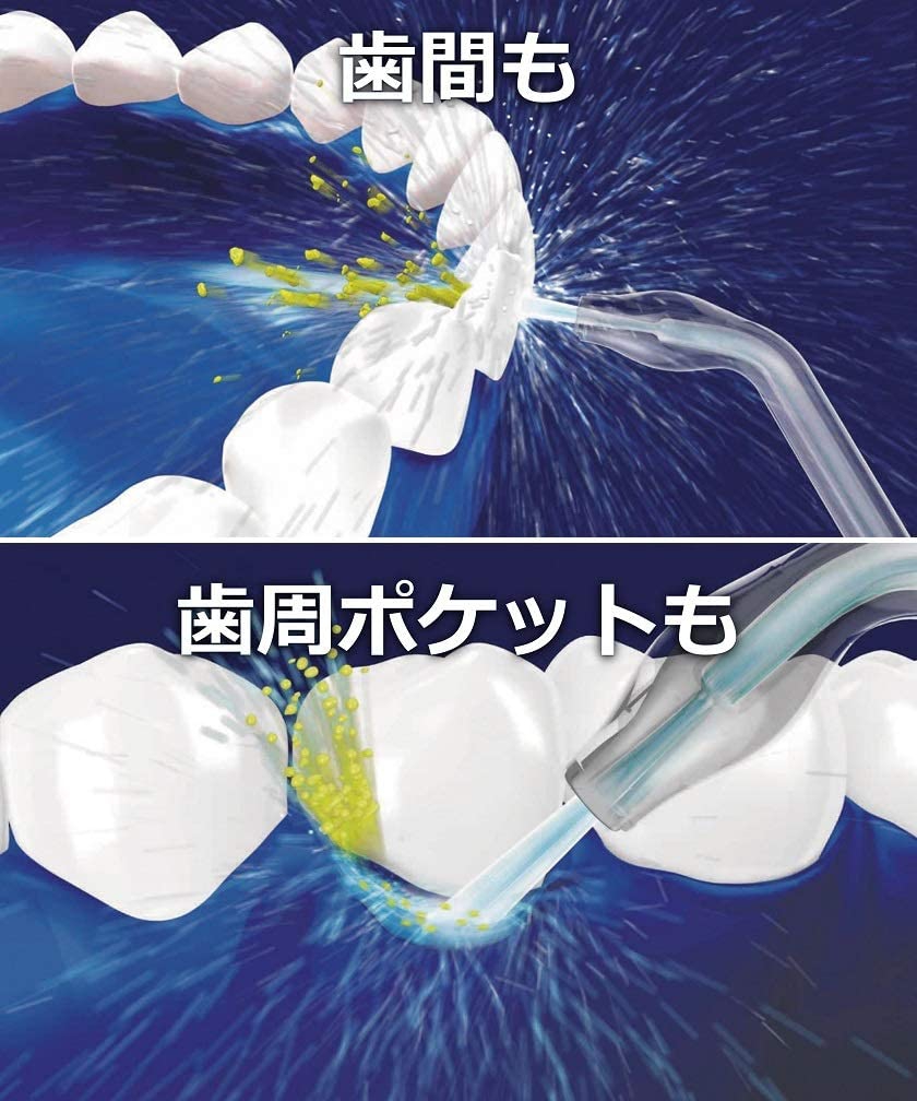 口腔洗浄器おすすめ人気ランキング8選【虫歯・歯周病予防に効果あり！】 | モノシル