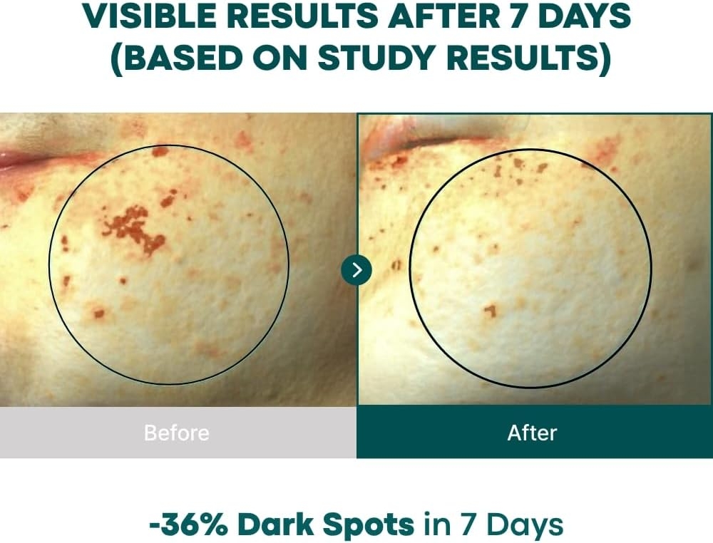 BONCEPT(ボンセㇷ゚ト) ビタCクリームの商品画像4 