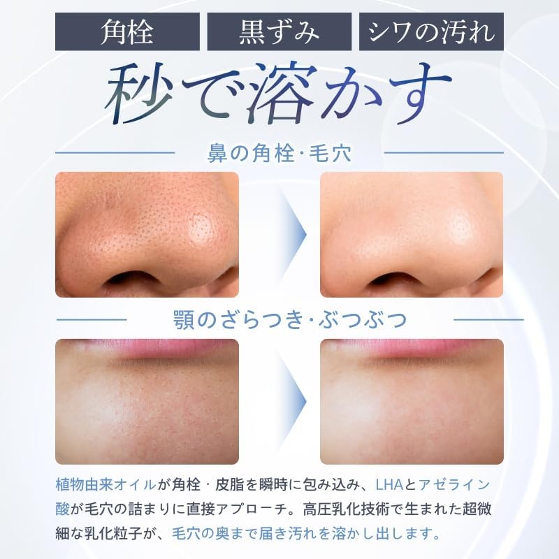 akaran+(アカランプラス) VCリペアクレンジングオイルの商品画像3