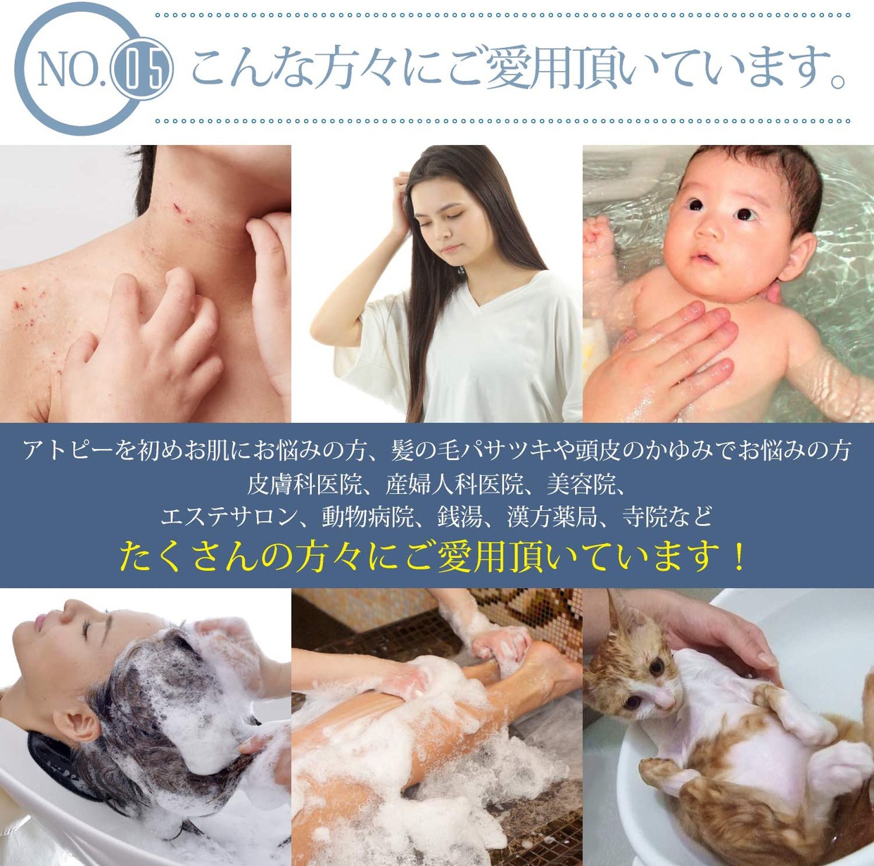 FORESTWATER(フォレストウォーター) 浄水シャワーCRIS TYPE-Nの商品画像7 