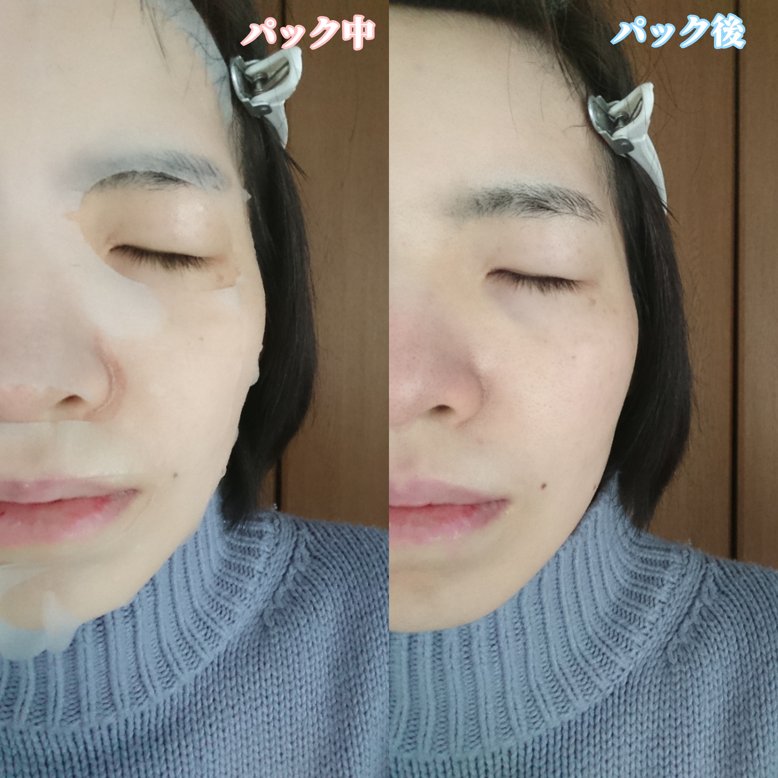 白真珠マスクを使ったYuKaRi♡さんのクチコミ画像6