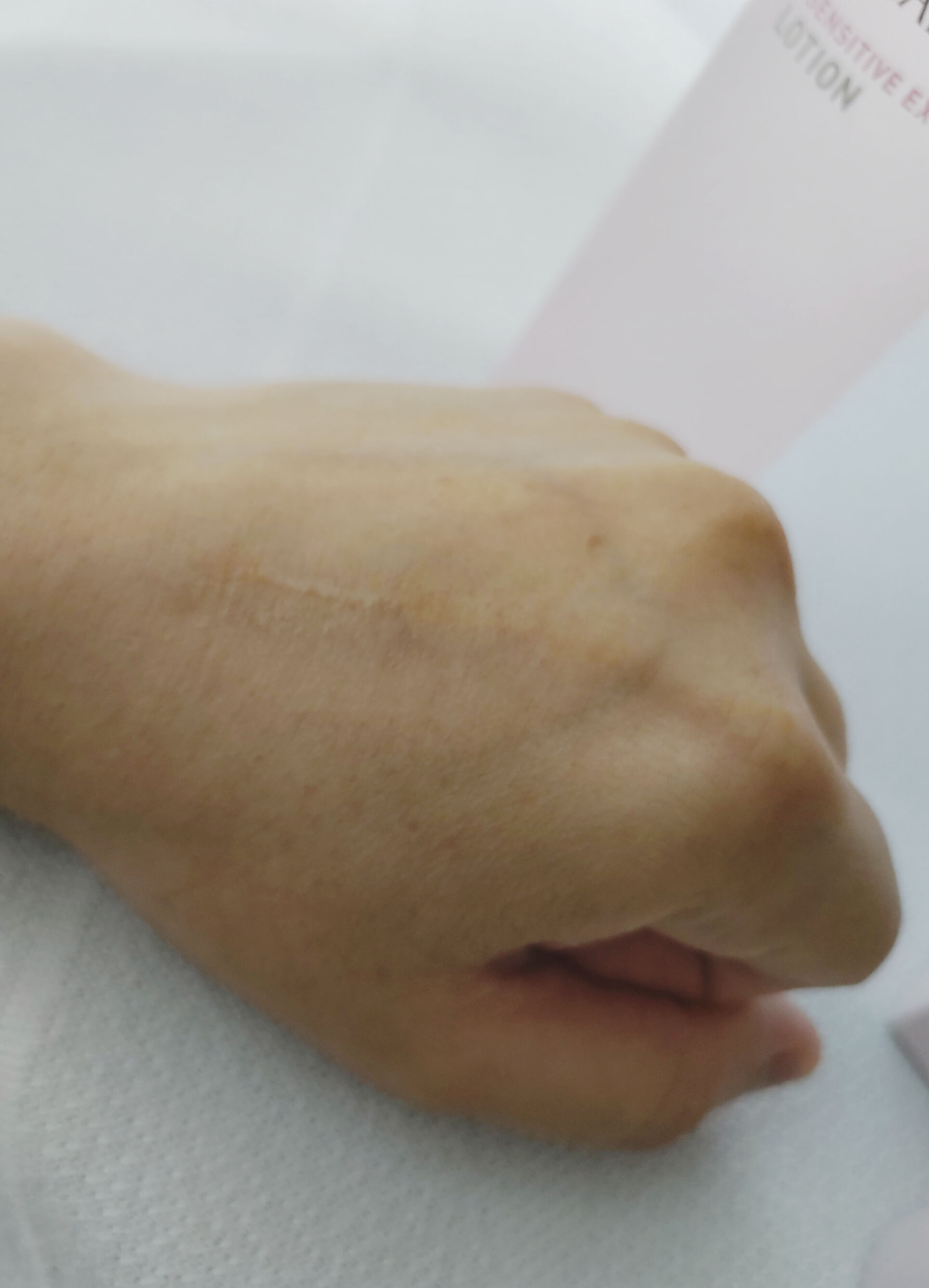 Dr.Ci:Labo(ドクターシーラボ) 薬用ローション スーパーセンシティブEXを使った恵未さんのクチコミ画像6