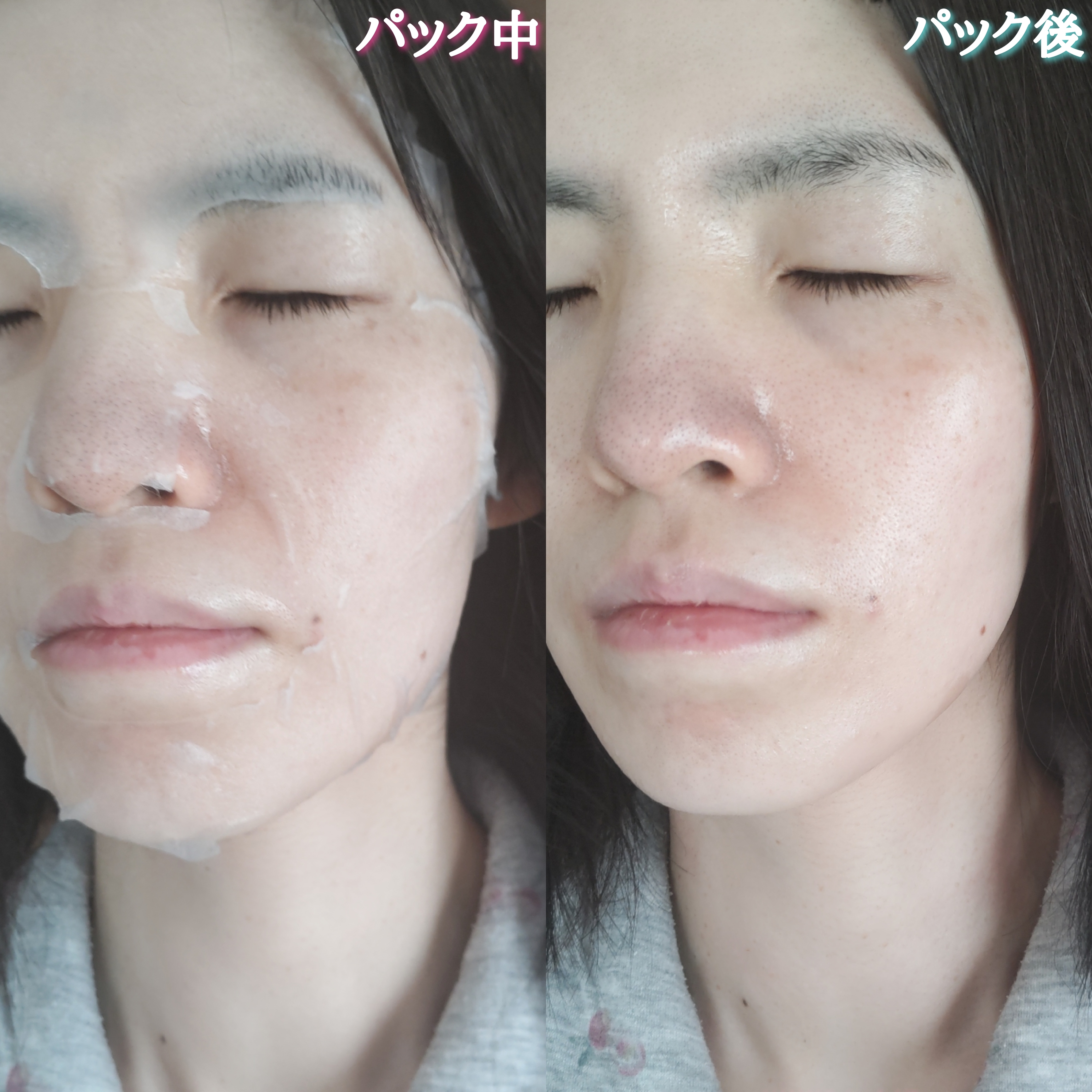ネイチャーリパブリック YOKUBARI パーフェクトバランシング ビタミンゼリーマスクを使ったYuKaRi♡さんのクチコミ画像6