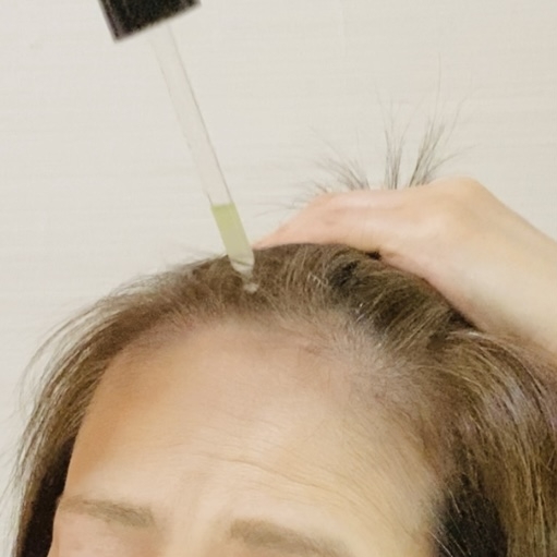商品名：薬用 メディカル アンチヘアロスセラム＜医薬部外品＞
販売名：ロクシタン アドバンスト スカルプケアの良い点・メリットに関するトラネコさんの口コミ画像2