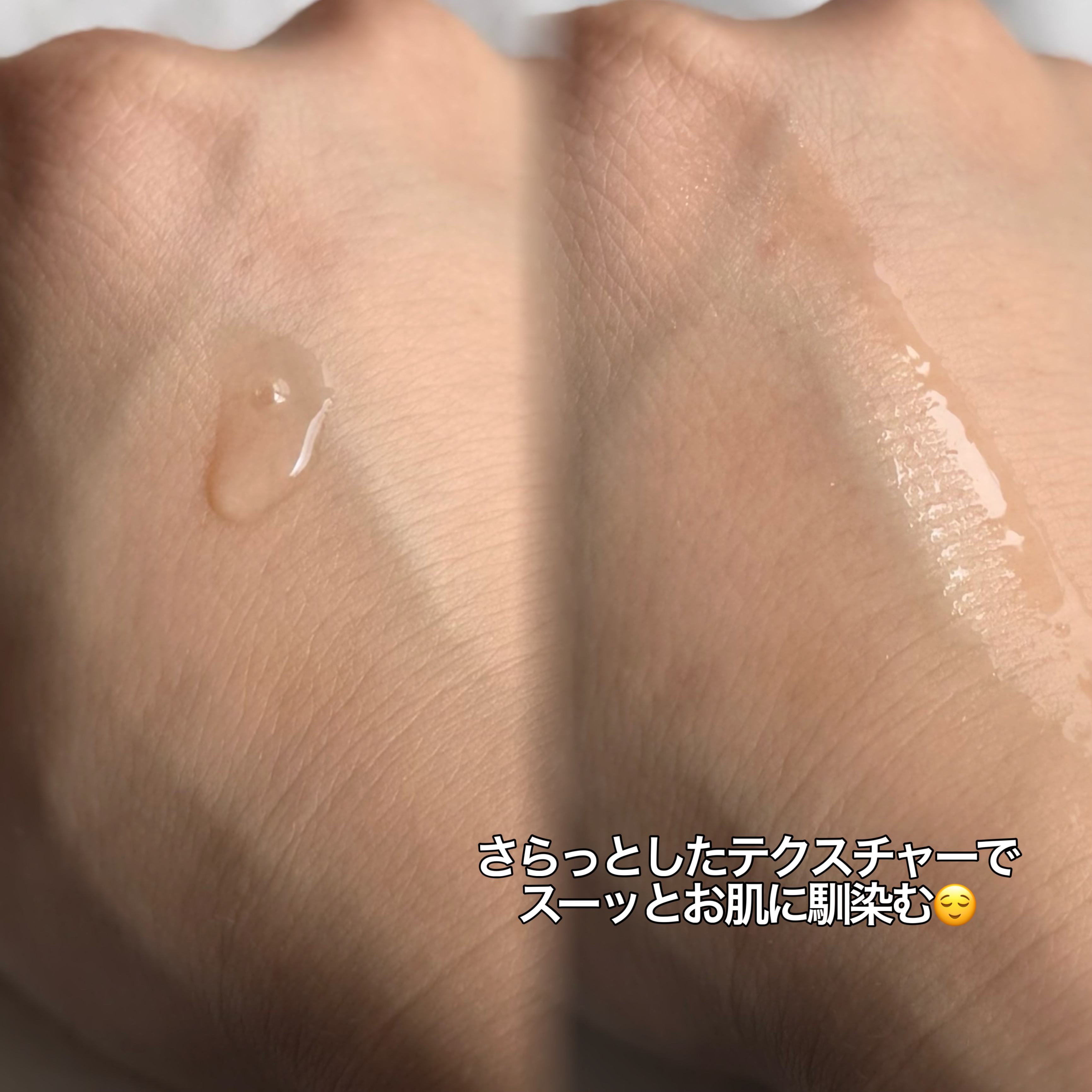 SKIN1004(スキンチョンサ) マダガスカル センテラ アンプルの良い点・メリットに関するKaraさんの口コミ画像2