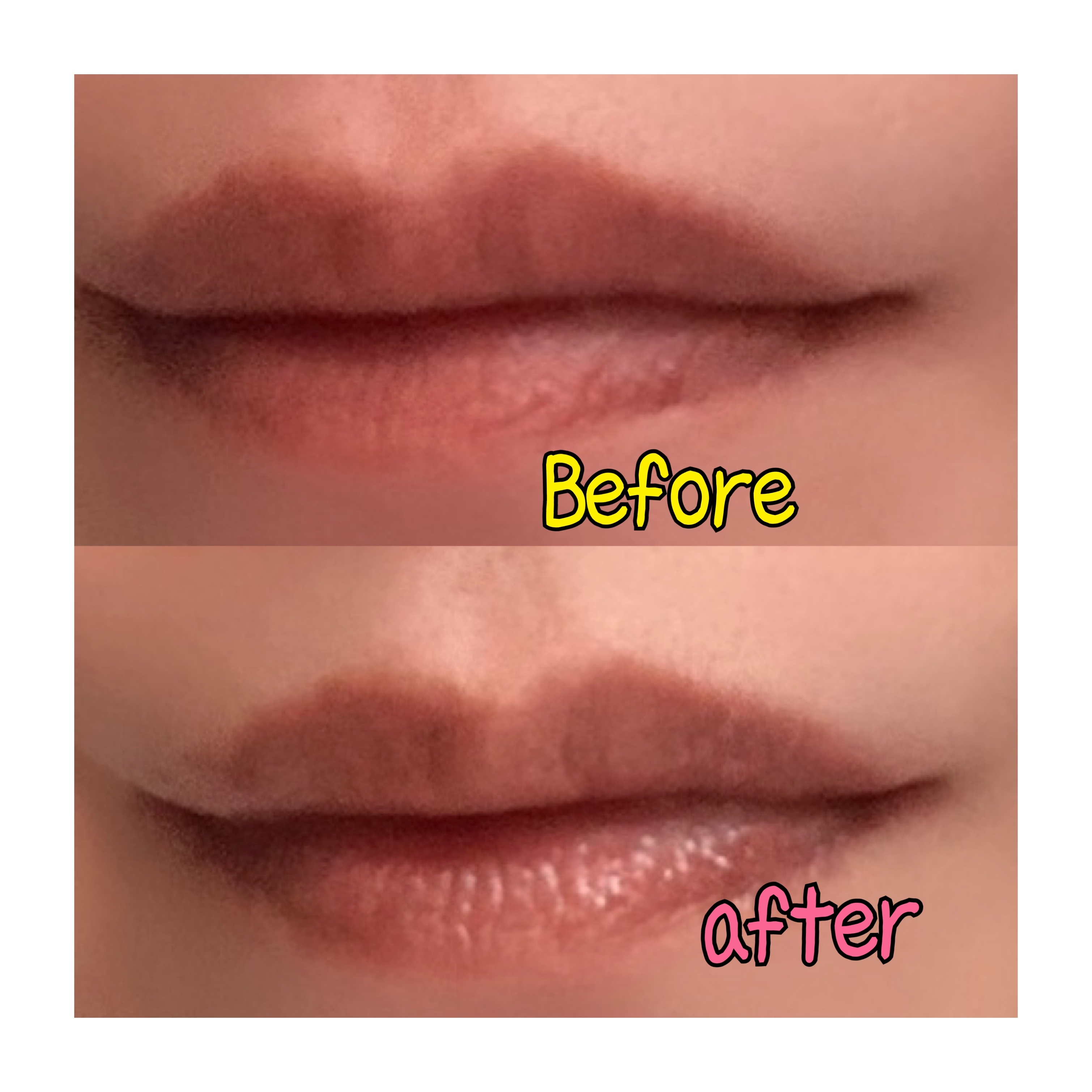 Apitherapy cosmetics(アピセラピーコスメティクス) RJビーリップの良い点・メリットに関するfumiさんの口コミ画像1