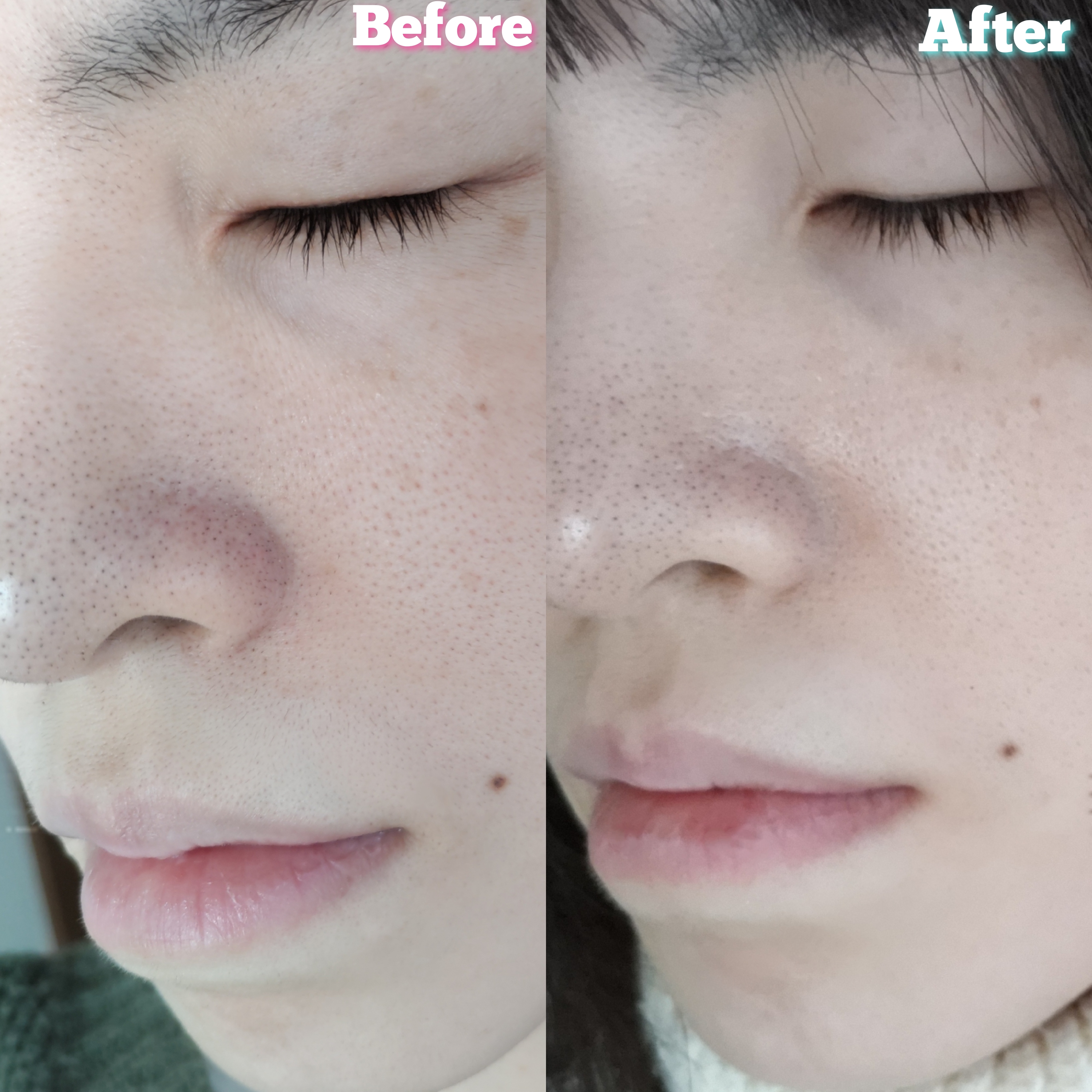ディープクリア酵素洗顔を使ったYuKaRi♡さんのクチコミ画像5