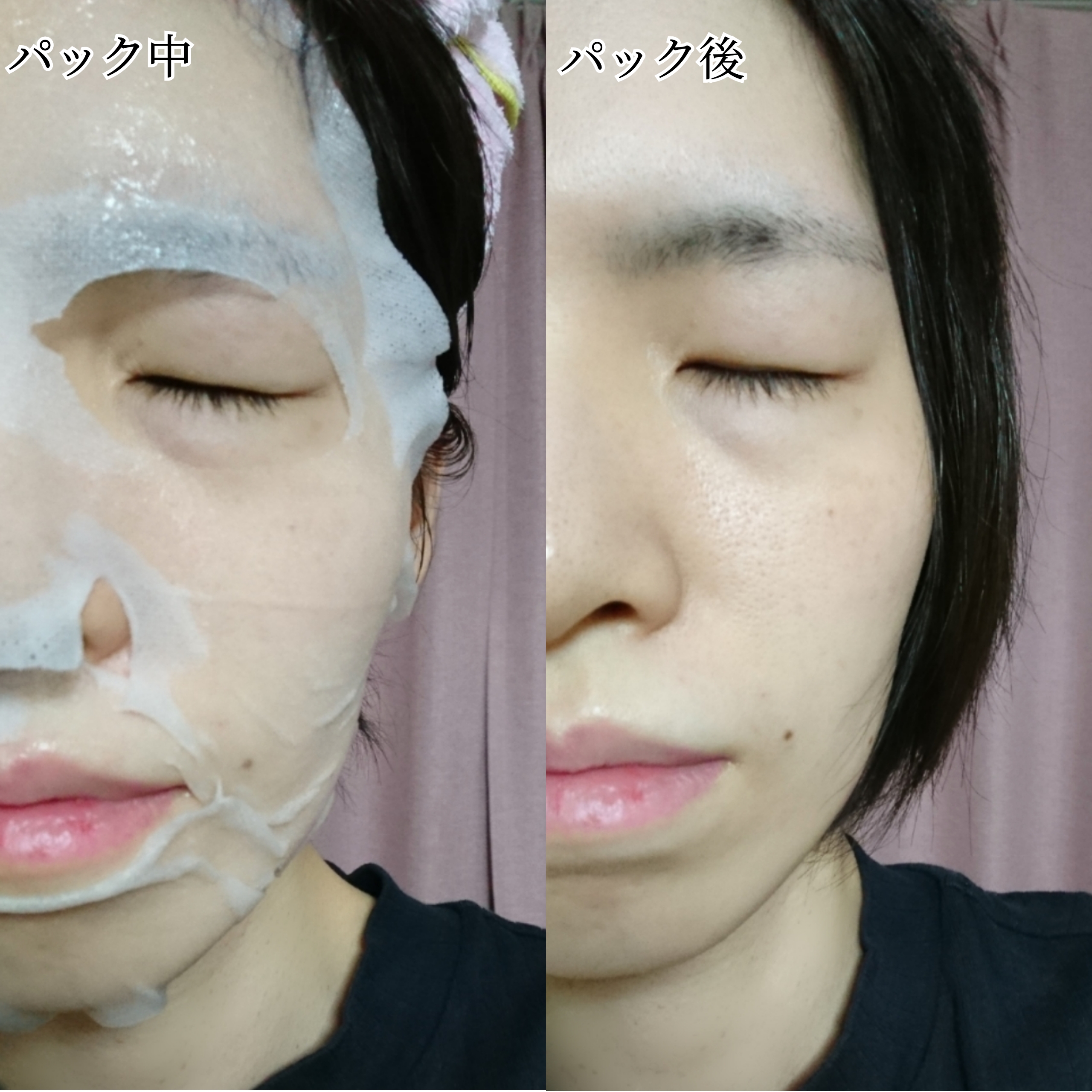 ティーツリー スキンマスクを使ったYuKaRi♡さんのクチコミ画像6
