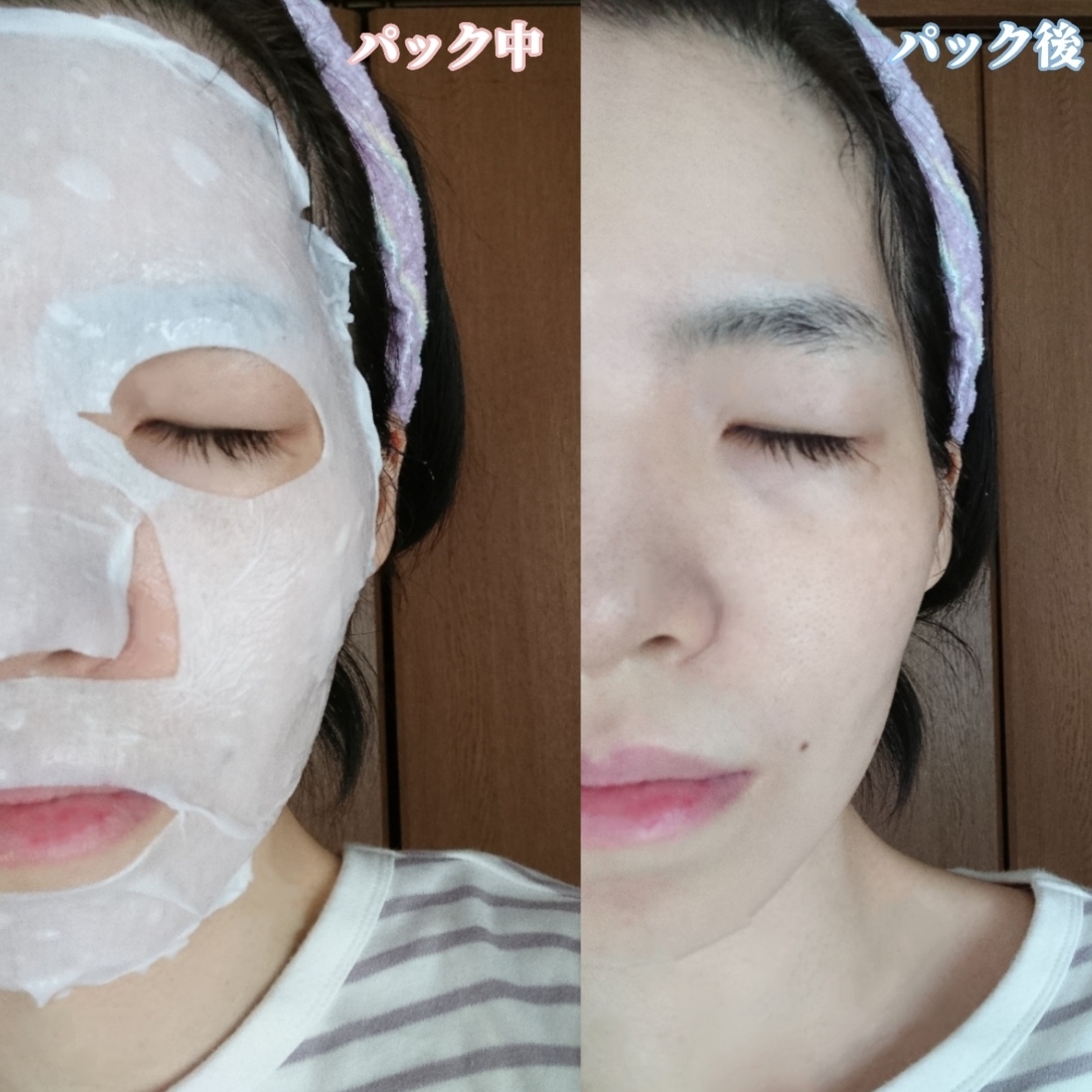 TheBOIBOY スキンフィットエッセンスマスクを使ったYuKaRi♡さんのクチコミ画像4