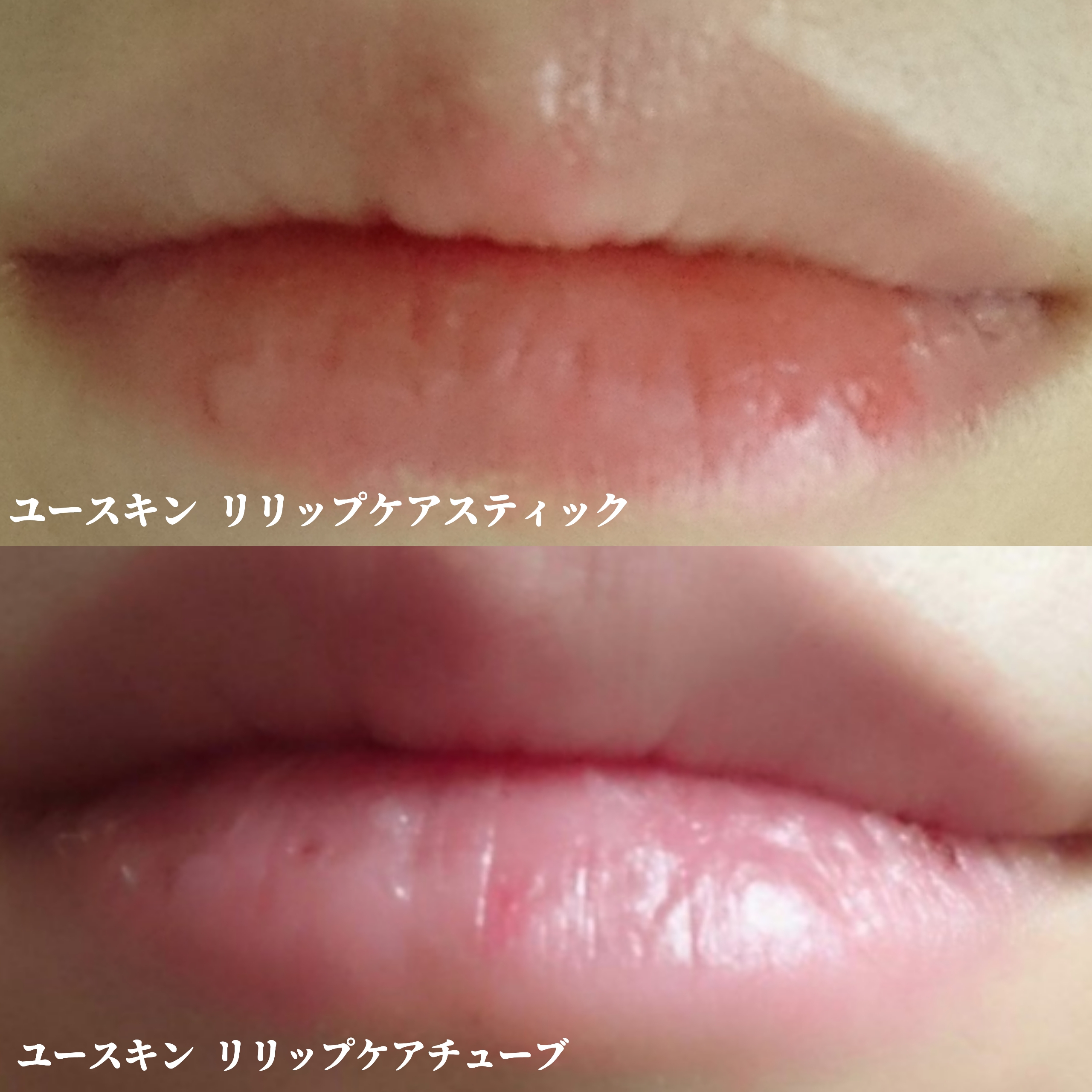唇荒れ対策に！リリップケアチューブ』by YuKaRi♡ : yuskin(ユースキン) リリップ ケアチューブの口コミ | モノシル