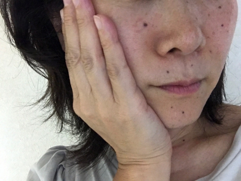 HIK(ヒク) セラムの良い点・メリットに関するkirakiranorikoさんの口コミ画像3