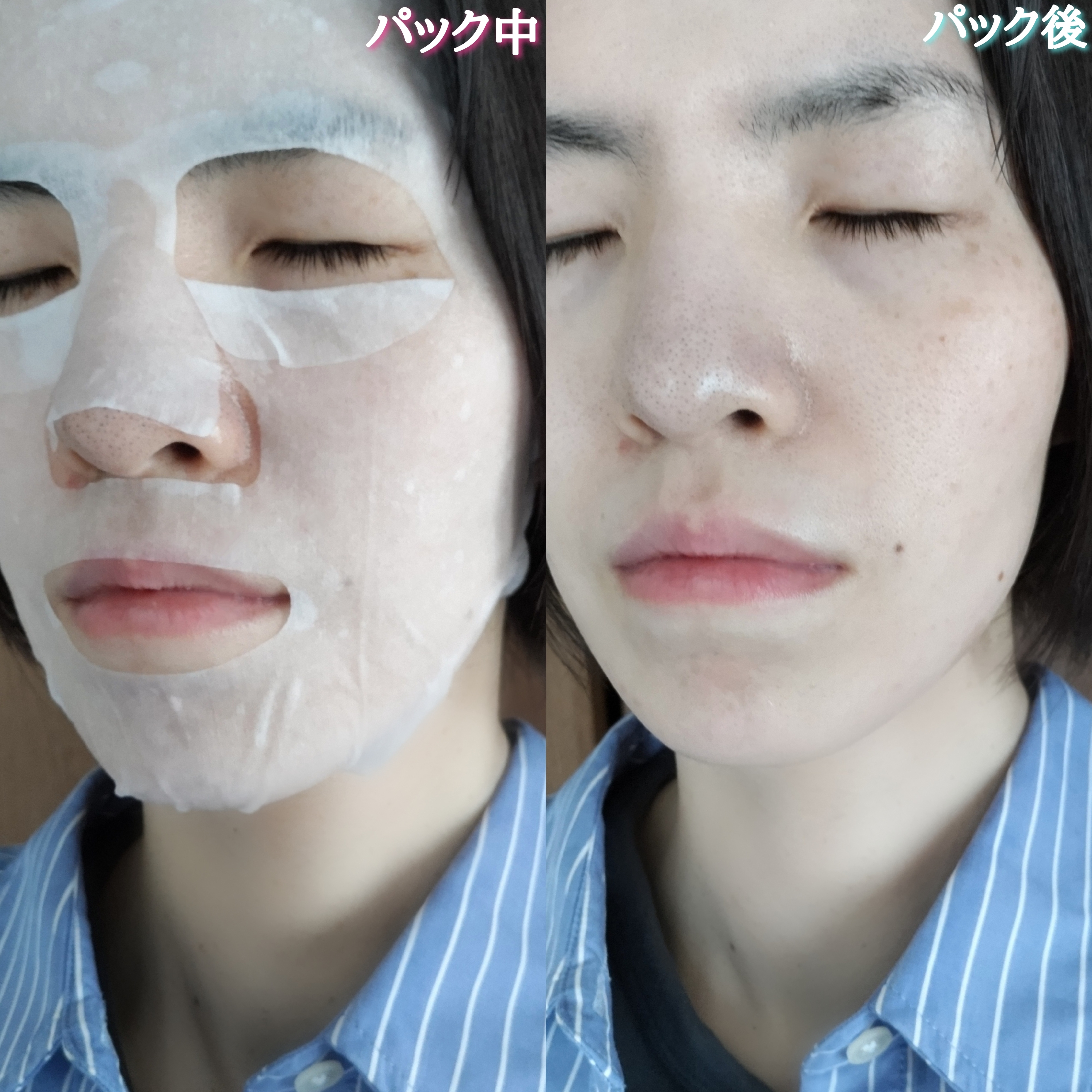 ジャパンギャルズ　EXO LABO マデカEXセラムマスクを使ったYuKaRi♡さんのクチコミ画像5