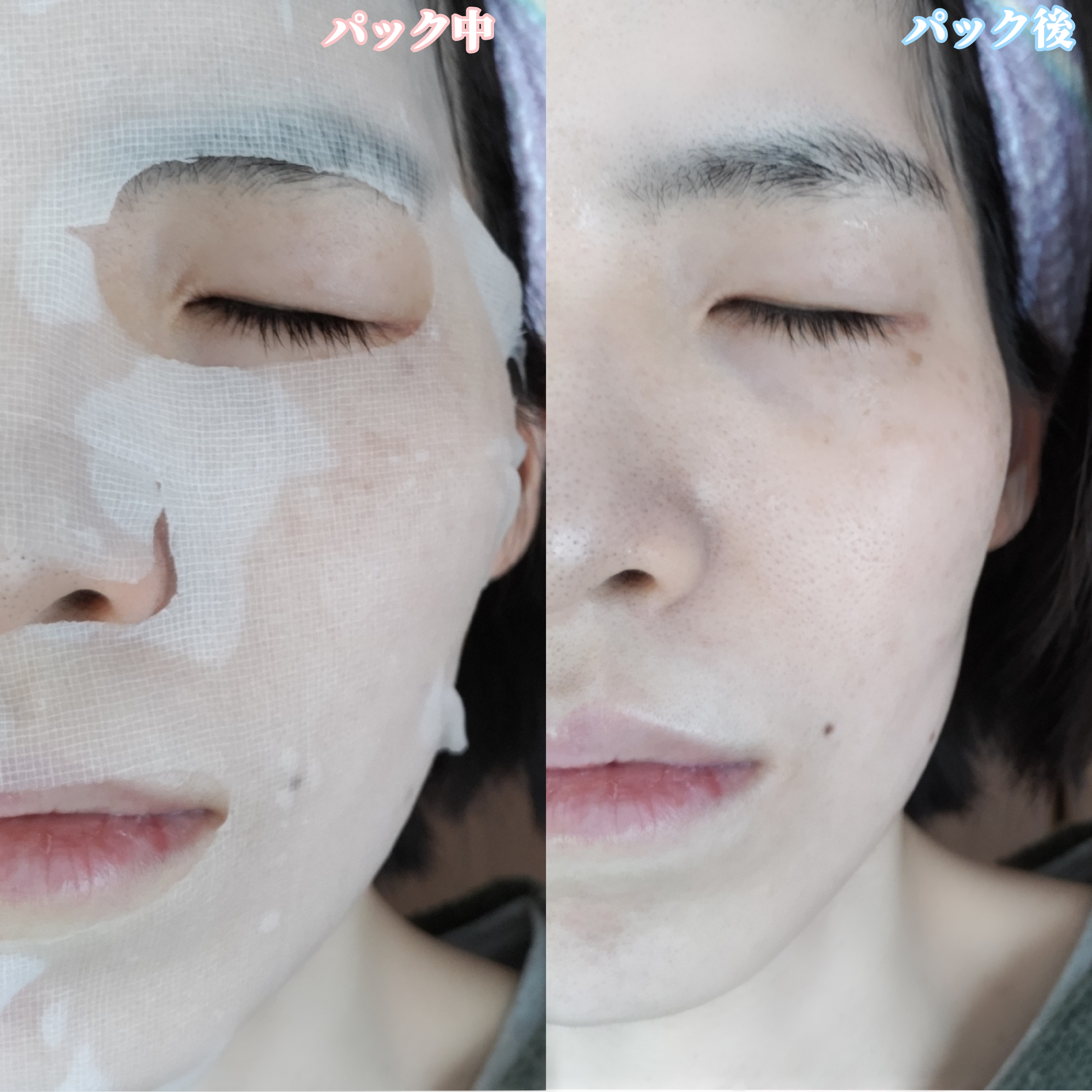 VT Cosmetics シカマスクシートを使ったYuKaRi♡さんのクチコミ画像6