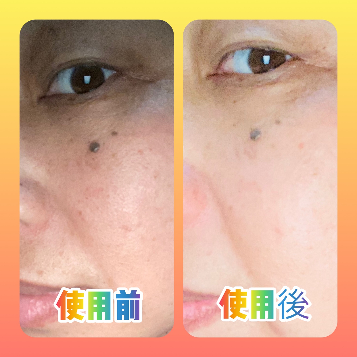 carenainai(ケアナイナイ) 酵素洗顔パウダーを使ったマイピコブーさんのクチコミ画像4