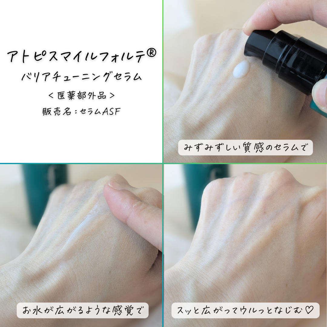 アトピスマイルフォルテを使ったつくねさんのクチコミ画像4