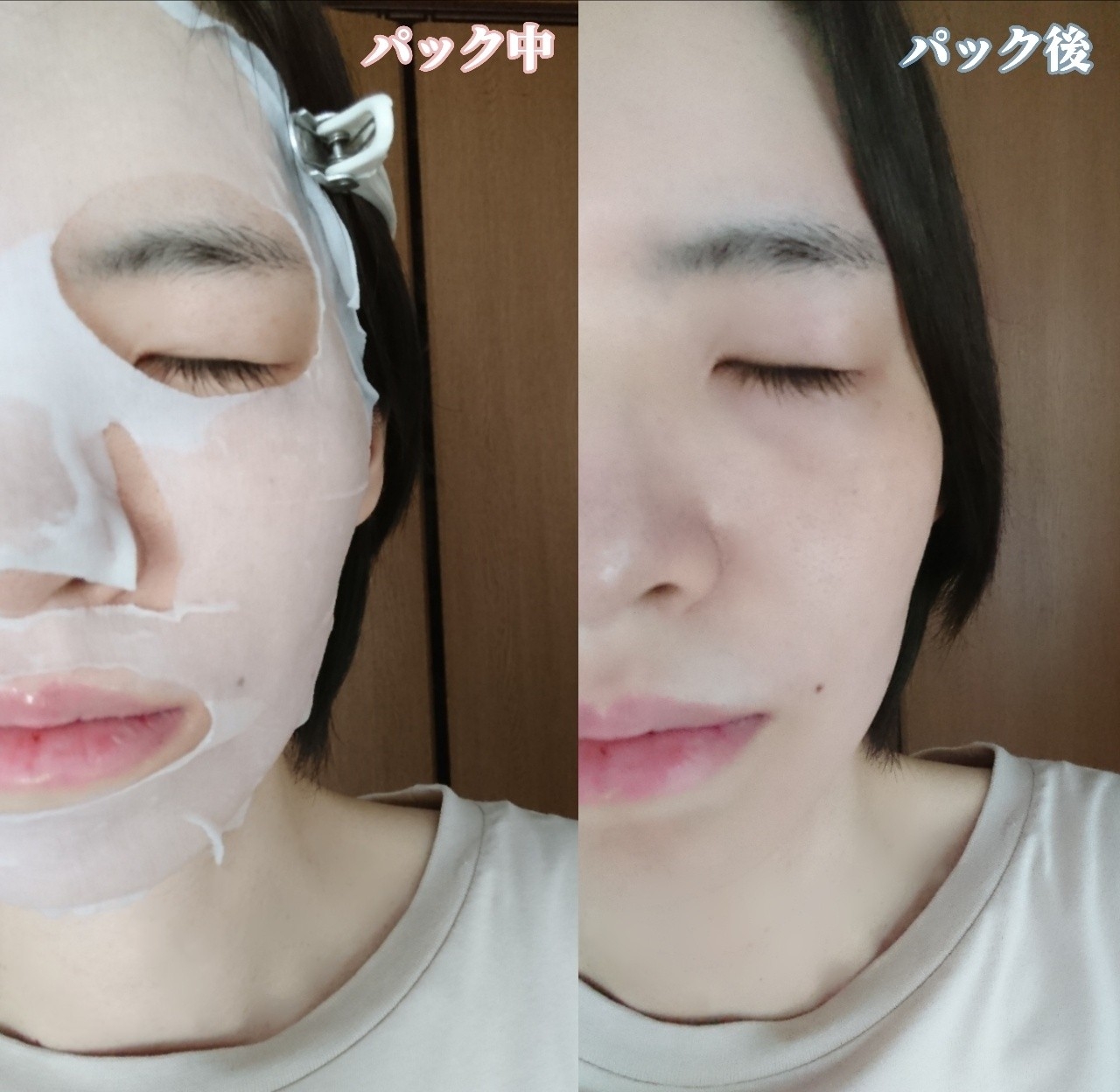 CHOIマスク 薬用ニキビケアを使ったYuKaRi♡さんのクチコミ画像6