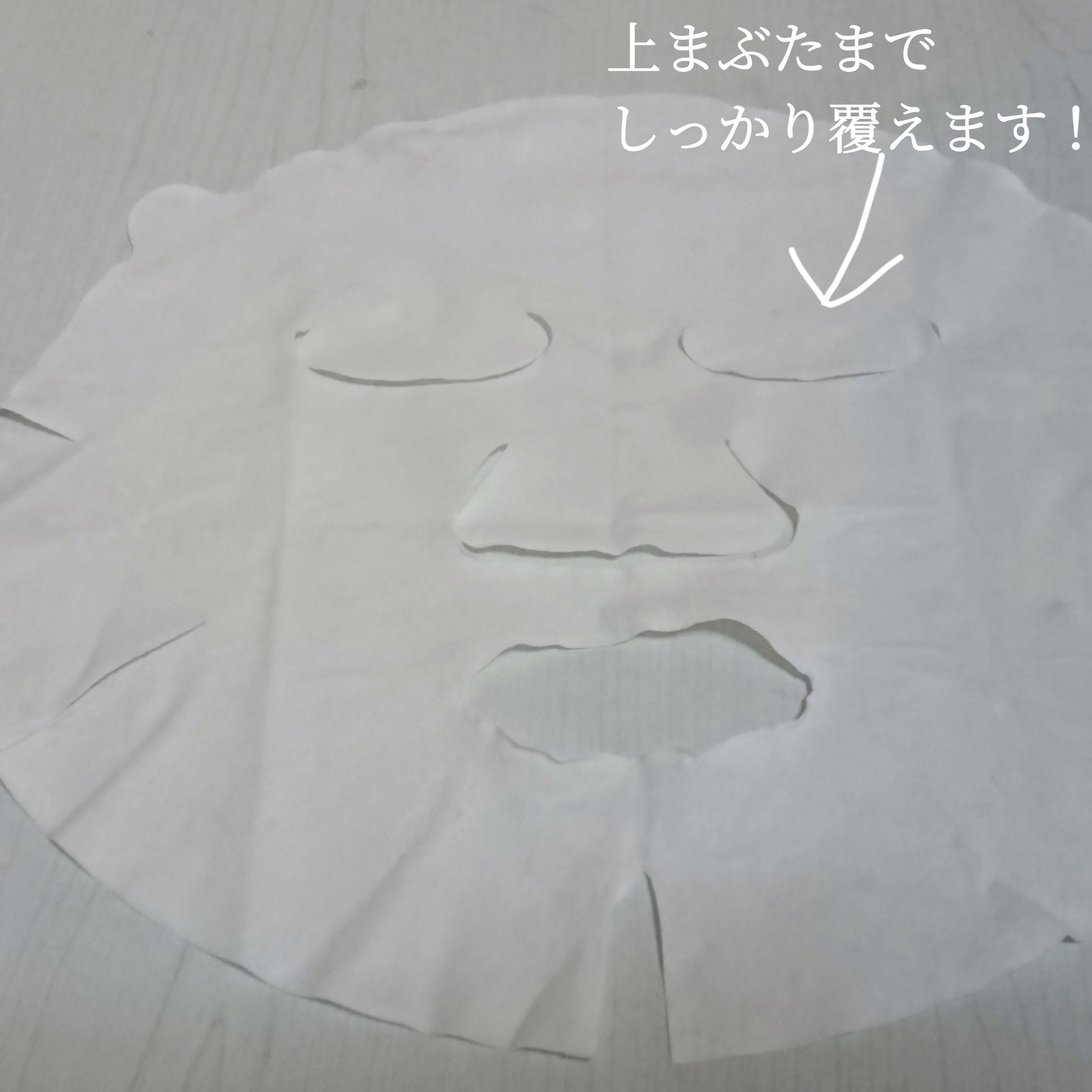 ETVOS 薬用ホワイトニングコンセントシートマスクを使ったYuKaRi♡さんのクチコミ画像5