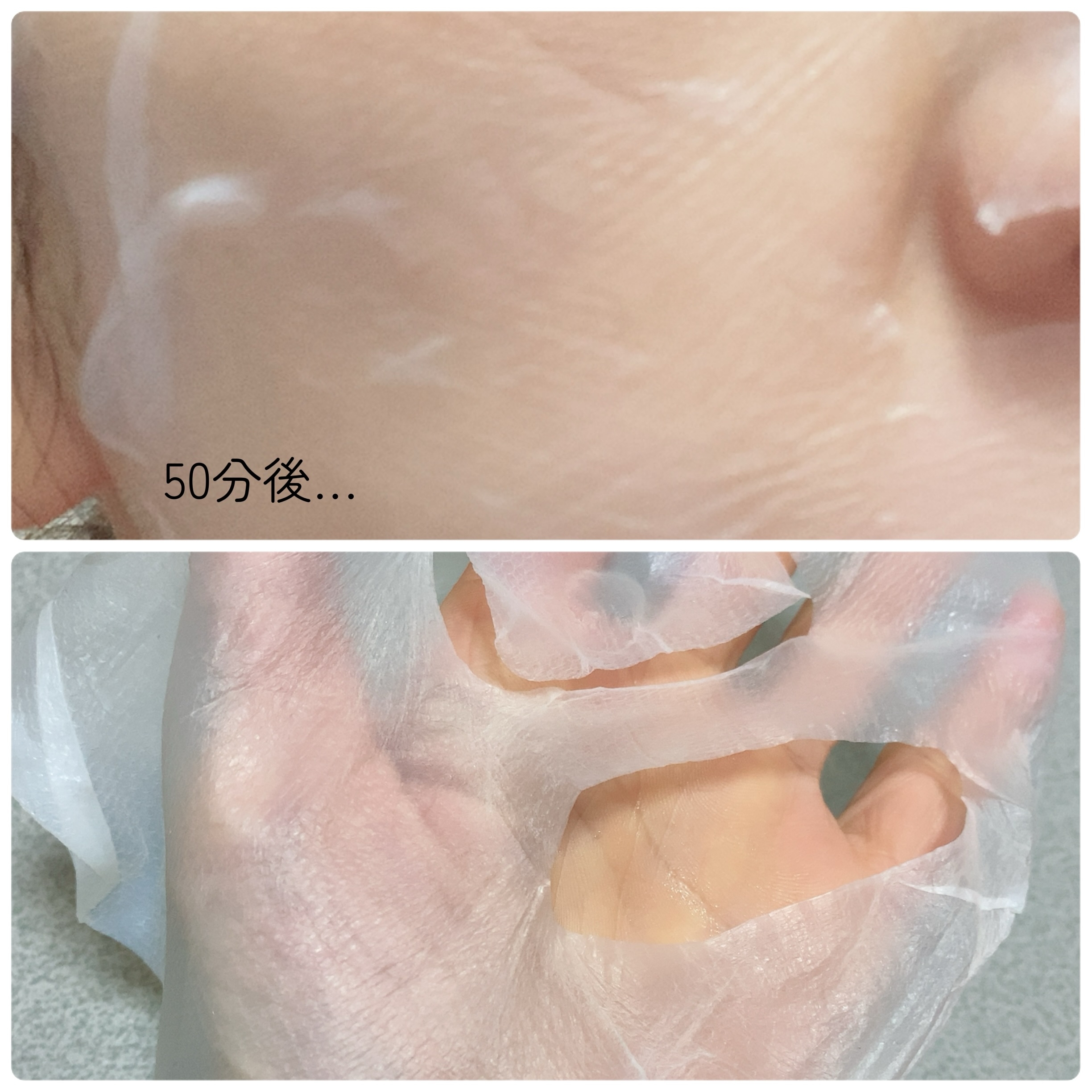 EIOM 
トラブルマスクパッチ イオムパックの良い点・メリットに関する珈琲豆♡さんの口コミ画像2