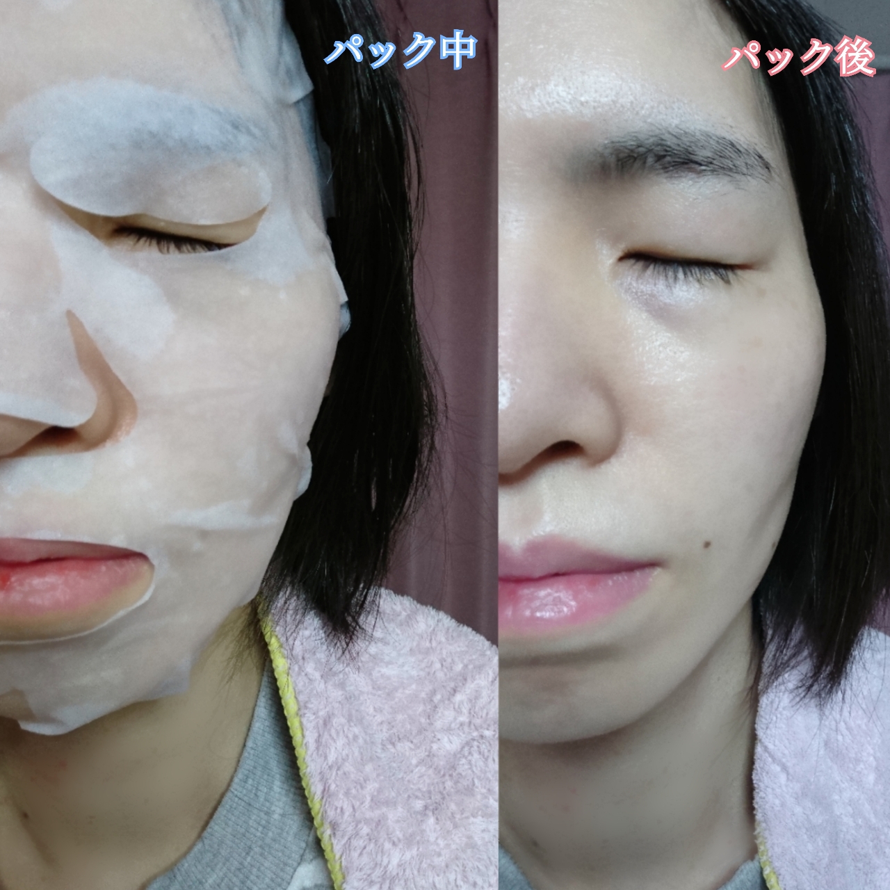 ETVOS 薬用ホワイトニングコンセントシートマスクを使ったYuKaRi♡さんのクチコミ画像6