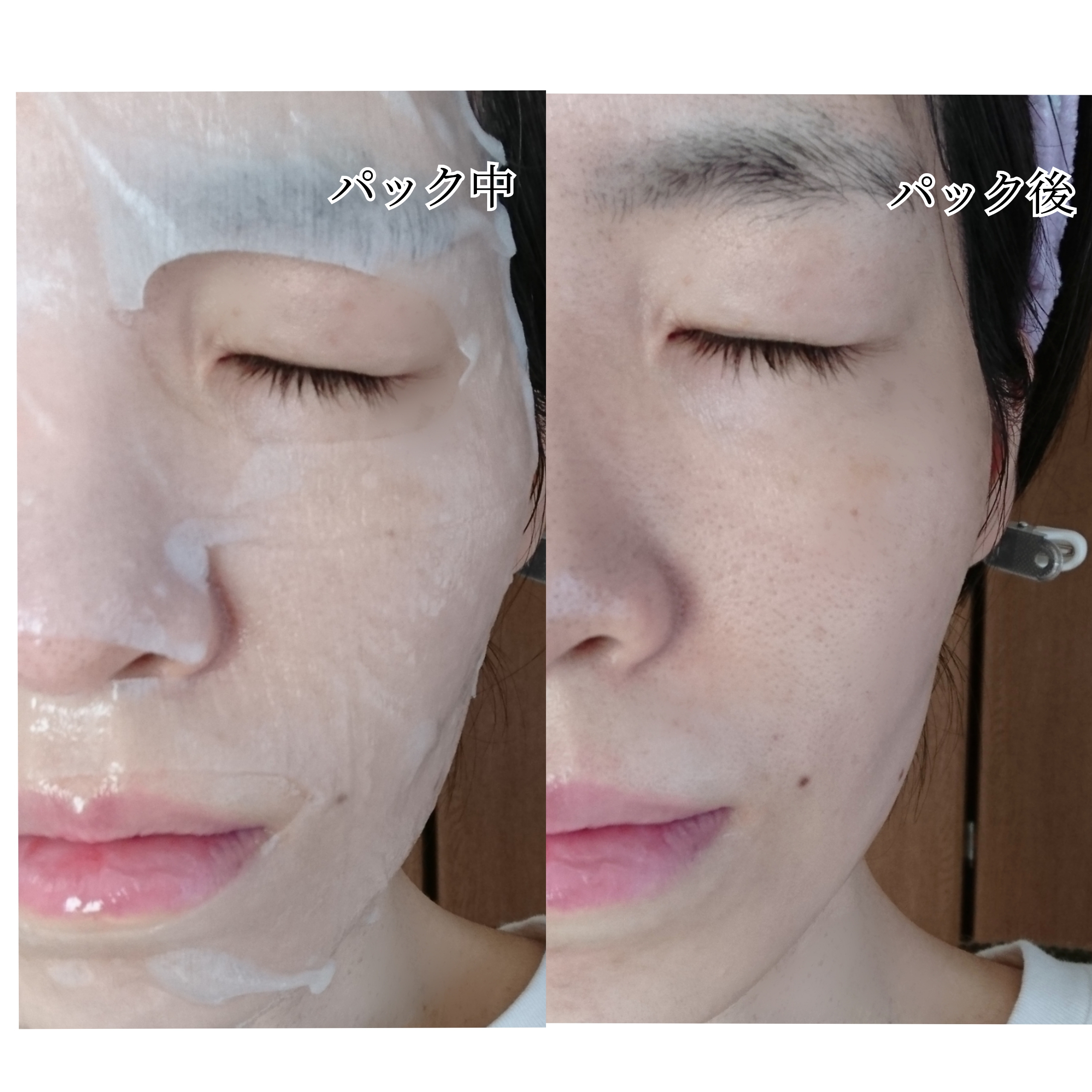 レッドブレミッシュ　クールスージングマスクを使ったYuKaRi♡さんのクチコミ画像7