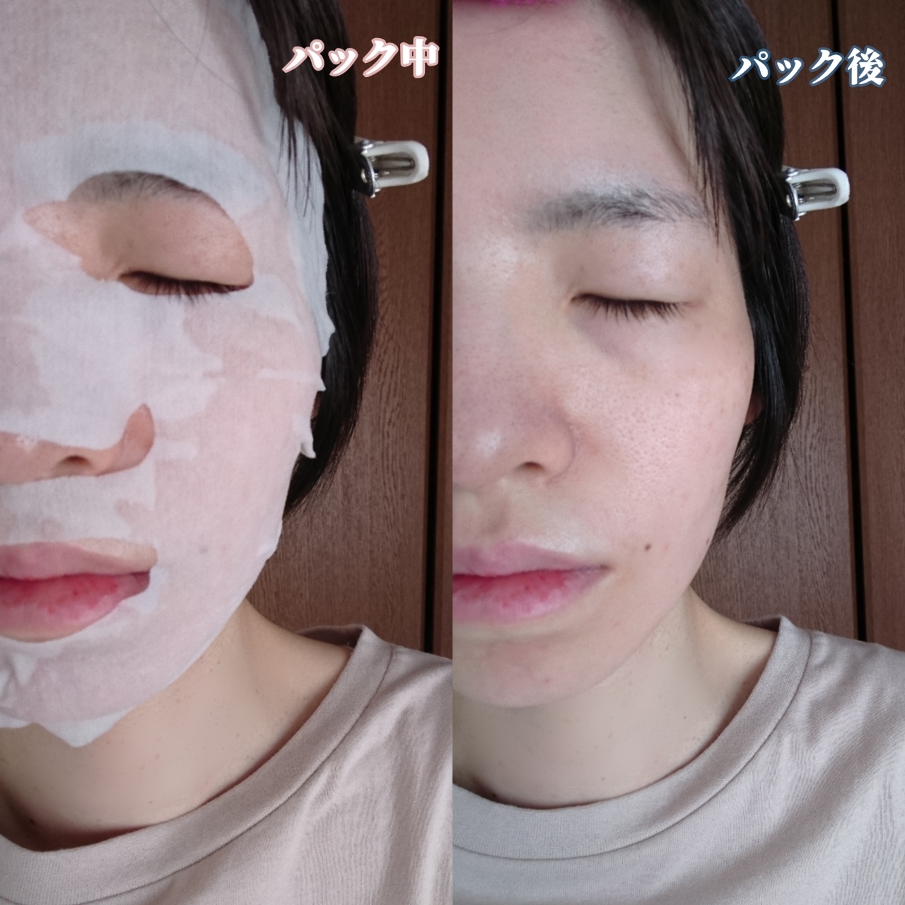 Saborino(サボリーノ)薬用 ひたっとマスク ACを使ったYuKaRi♡さんのクチコミ画像5