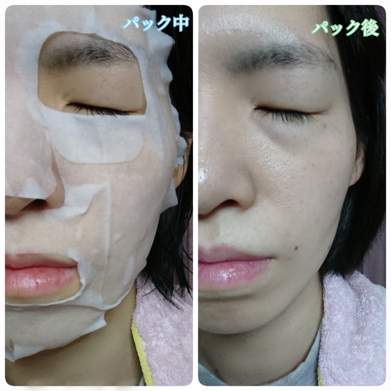 Ryuspa Refining フェイスシートマスクを使ったYuKaRi♡さんのクチコミ画像8
