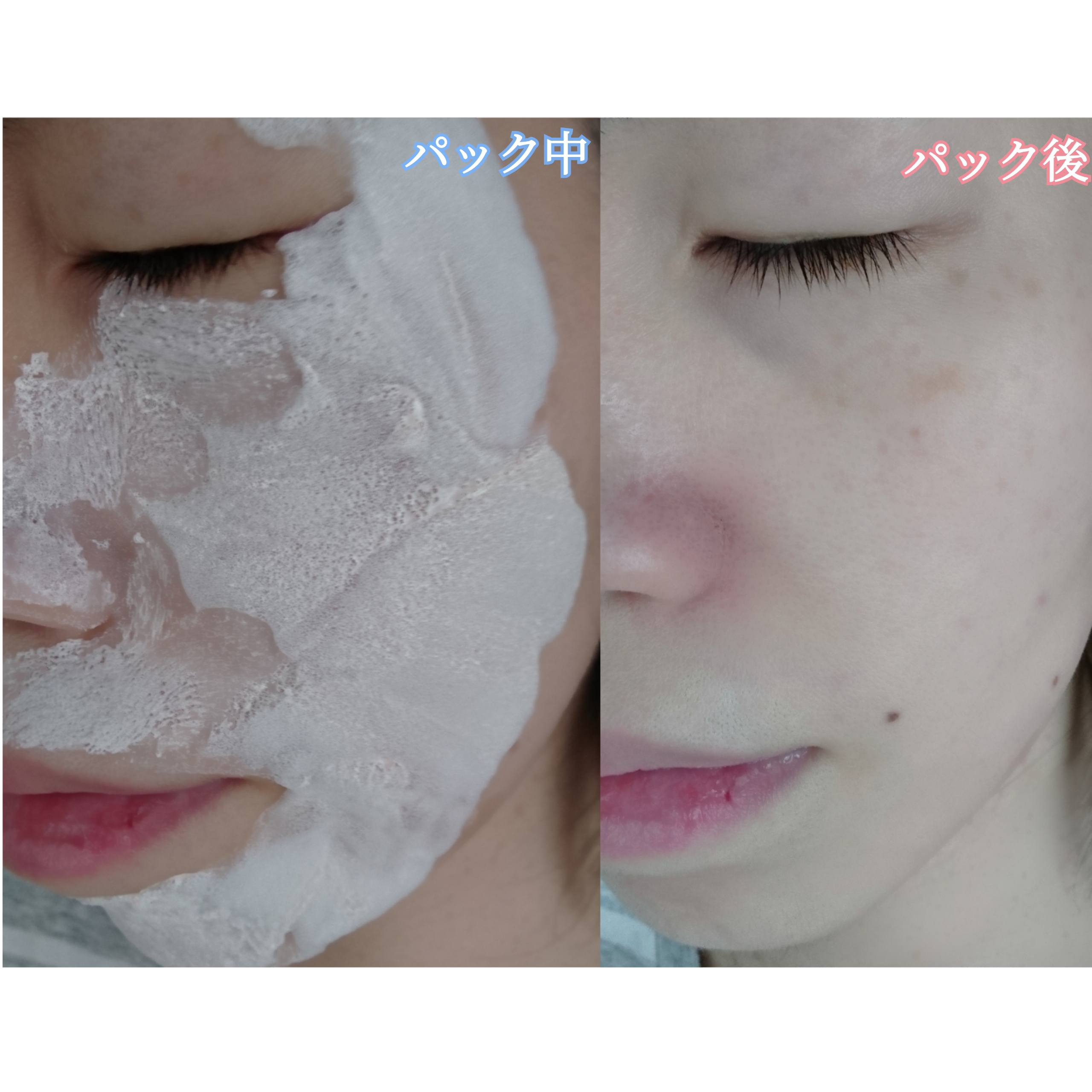 フレッシュ バブル パックを使ったYuKaRi♡さんのクチコミ画像5