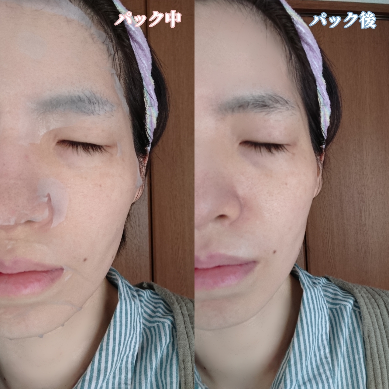 TheBOIBOY アンプルウォーターゲルマスクを使ったYuKaRi♡さんのクチコミ画像4