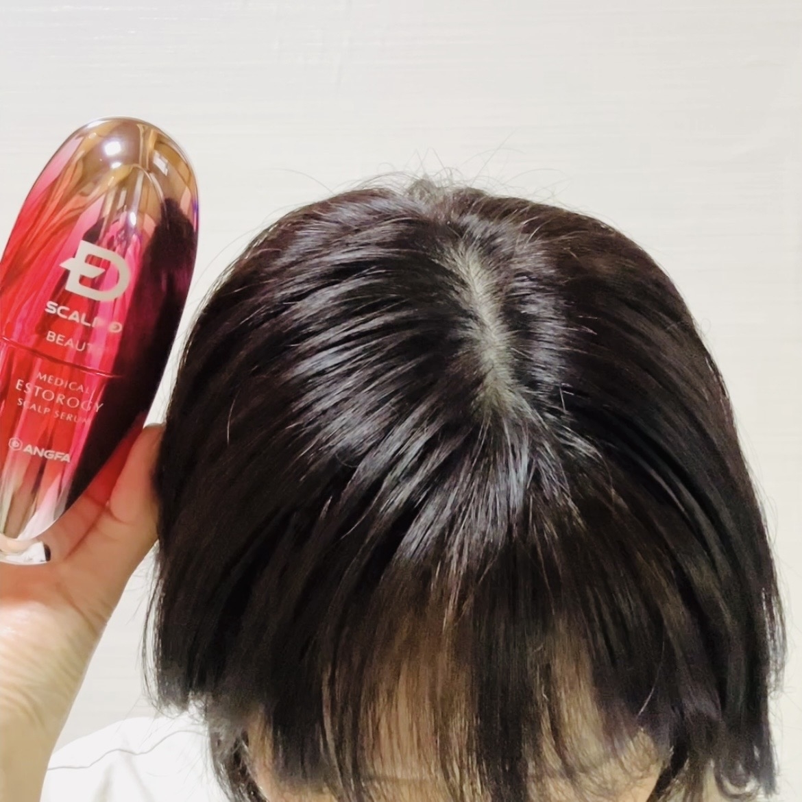 エストロジー スカルプセラムを使ったトラネコさんのクチコミ画像4