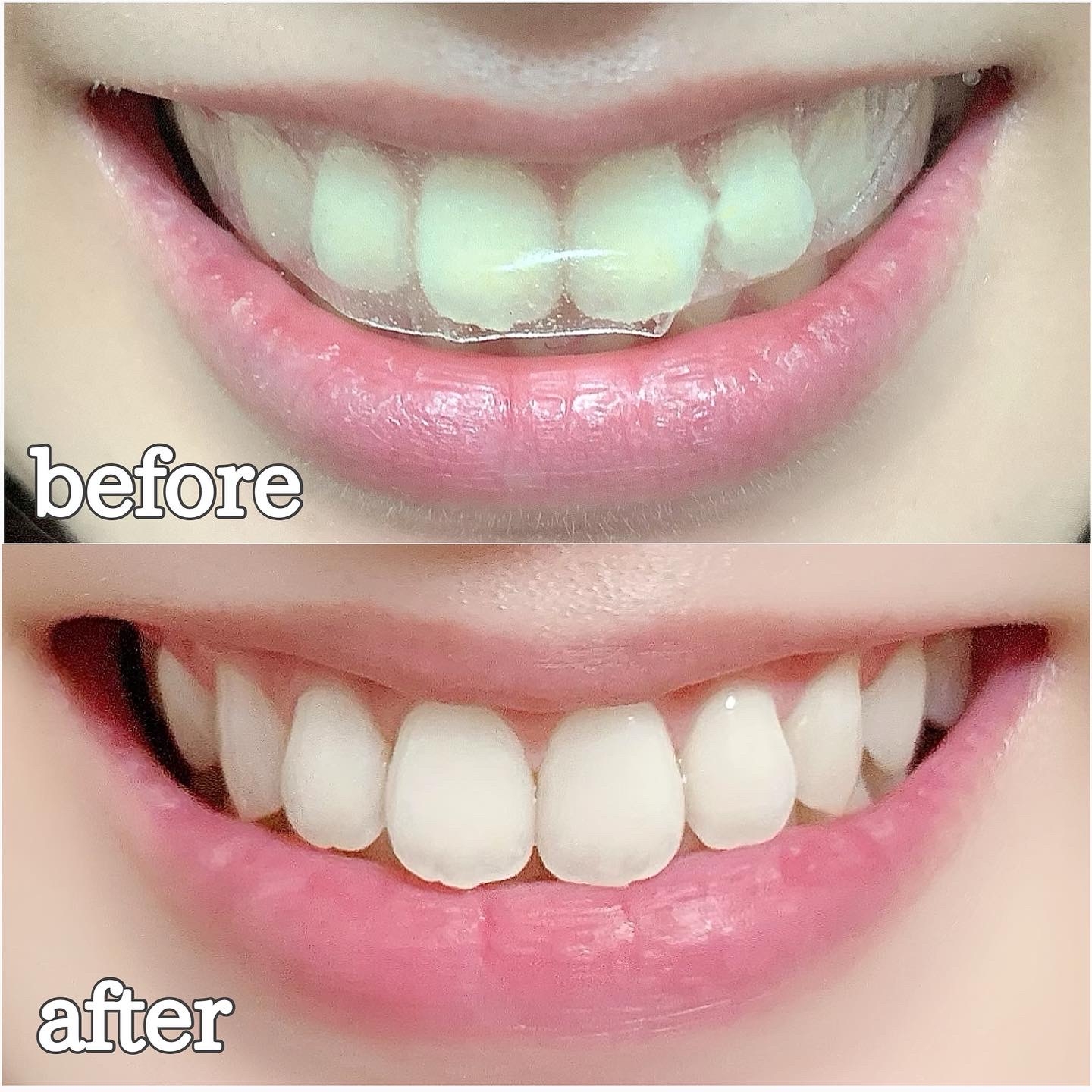武内製薬 THE 歯の黄ばみ 集中ケアパックの良い点・メリットに関するまみやこさんの口コミ画像3