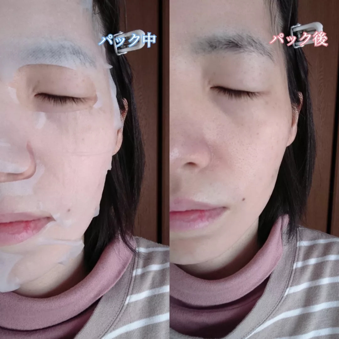 RISM デイリーケアマスク(ヒアルロン酸&グレープフルーツ)を使ったYuKaRi♡さんのクチコミ画像6