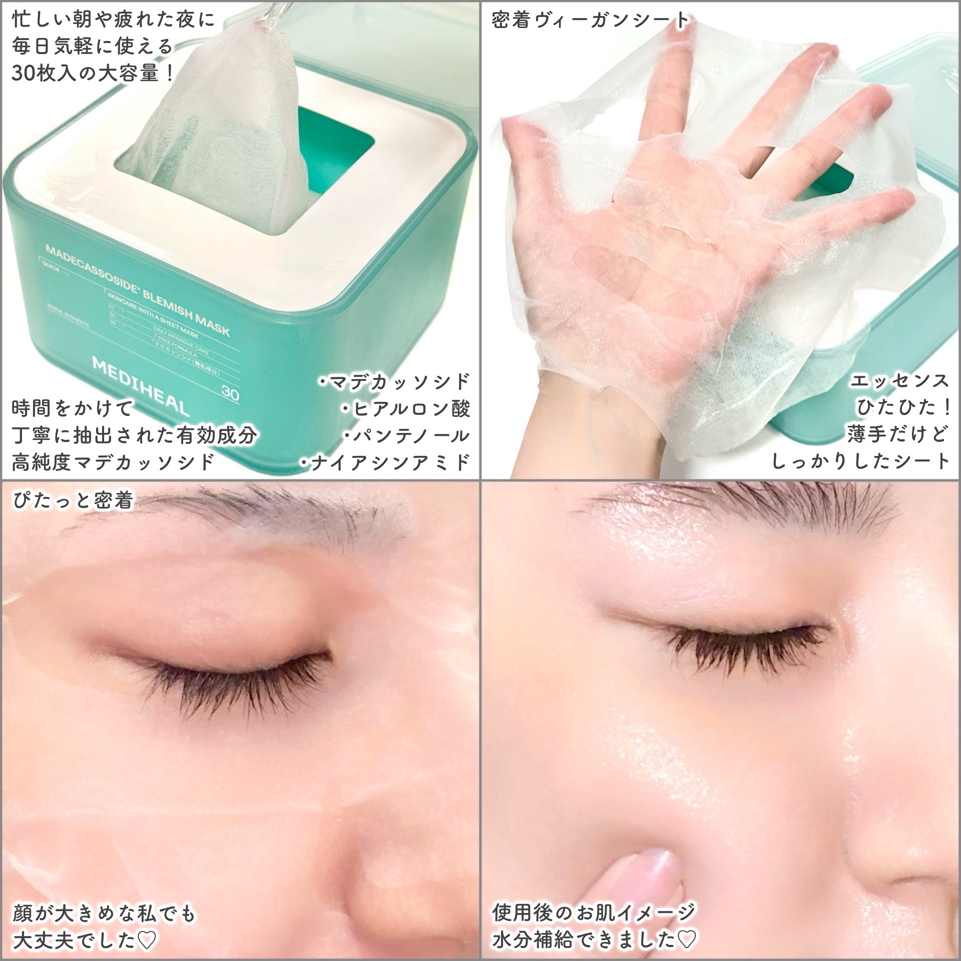 MEDIHEAL(メディヒール) マデカソサイド ブレミッシュパッドの良い点・メリットに関するEririnさんの口コミ画像2
