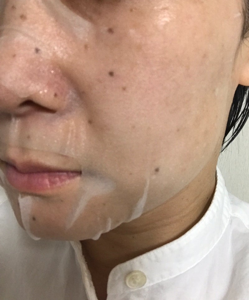 我的美麗日記（私のきれい日記）　VCクリアマスクを使ったkirakiranorikoさんのクチコミ画像9