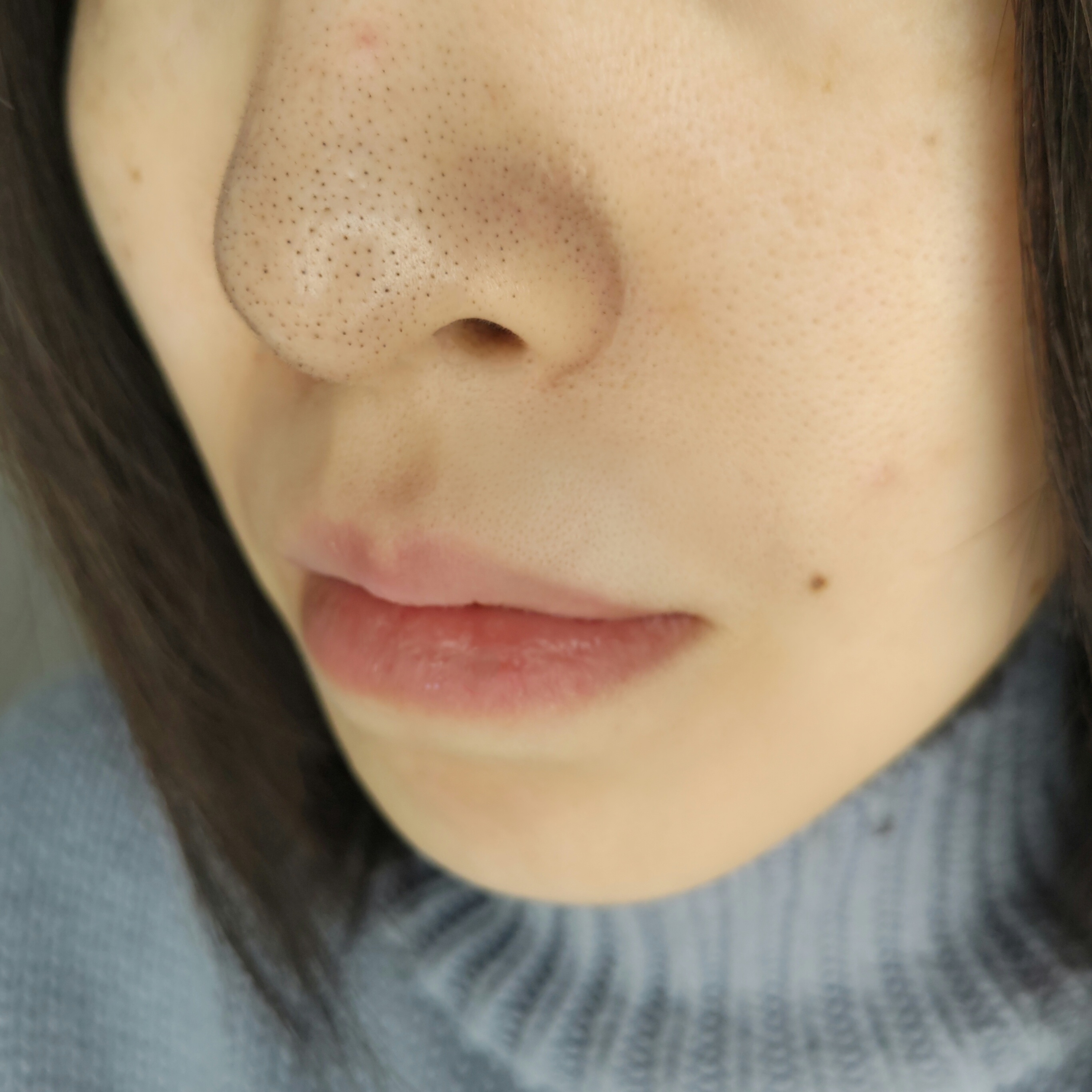 薬用しみ集中対策 美容液を使ったYuKaRi♡さんのクチコミ画像5