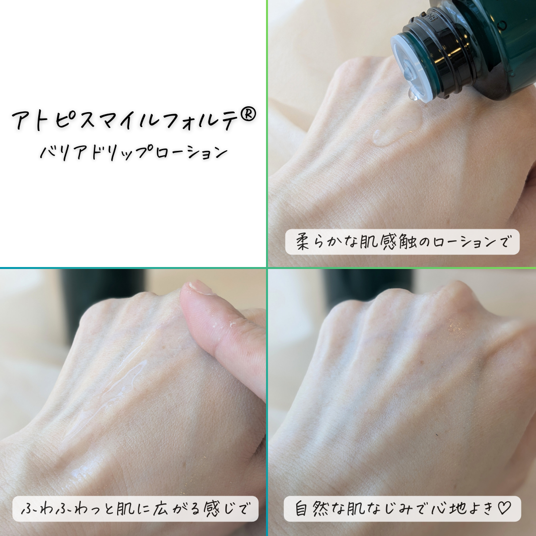 アトピスマイルフォルテを使ったつくねさんのクチコミ画像6