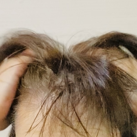 商品名：薬用 メディカル アンチヘアロスセラム＜医薬部外品＞
販売名：ロクシタン アドバンスト スカルプケアの良い点・メリットに関するトラネコさんの口コミ画像3