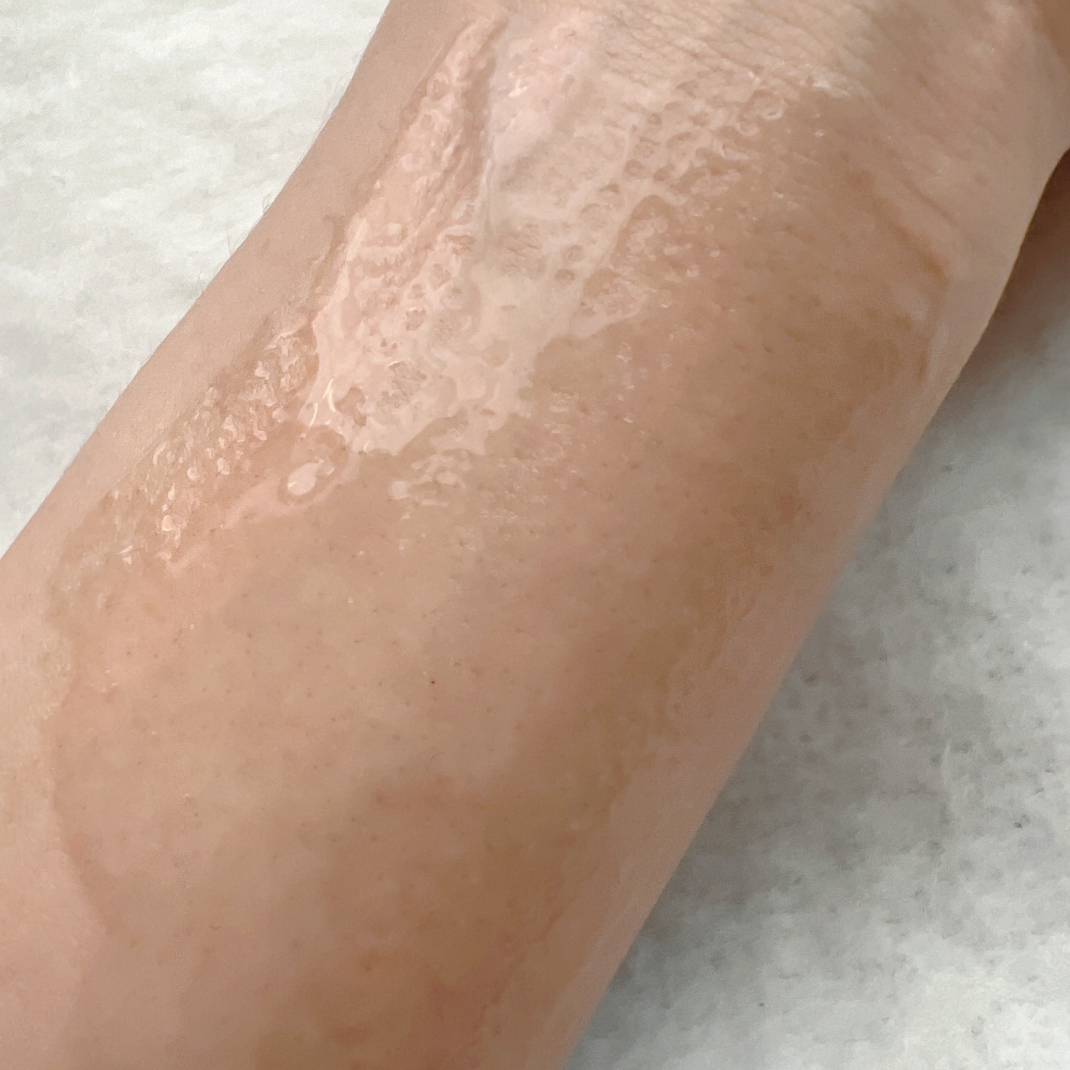 irohaVIO treatment lotionを使ったyungさんのクチコミ画像2