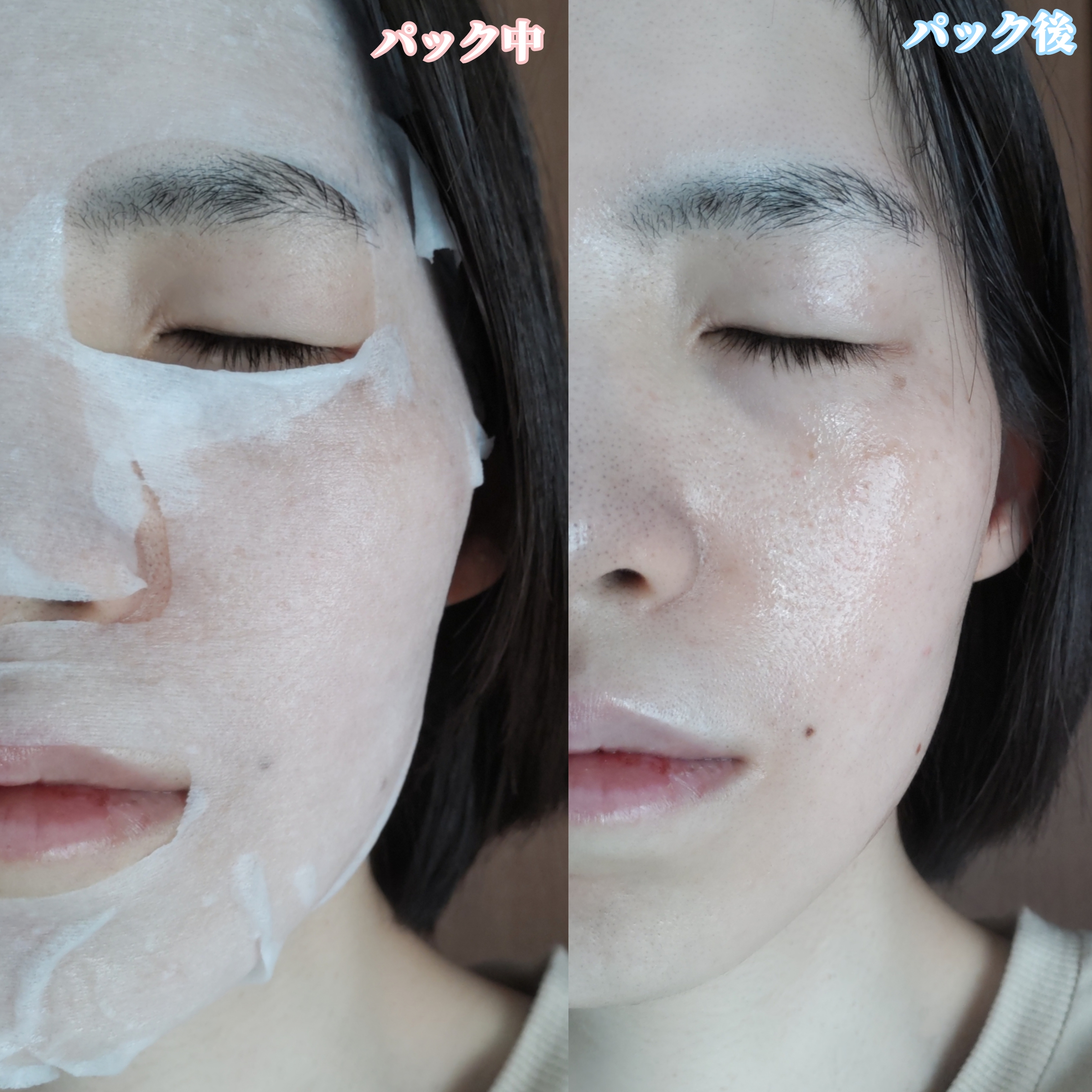 ポッシュコッシュ　AGマスクを使ったYuKaRi♡さんのクチコミ画像6
