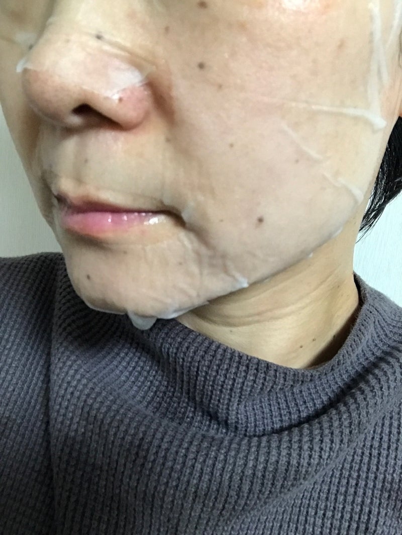 シカアルブチンマスクを使ったkirakiranorikoさんのクチコミ画像4