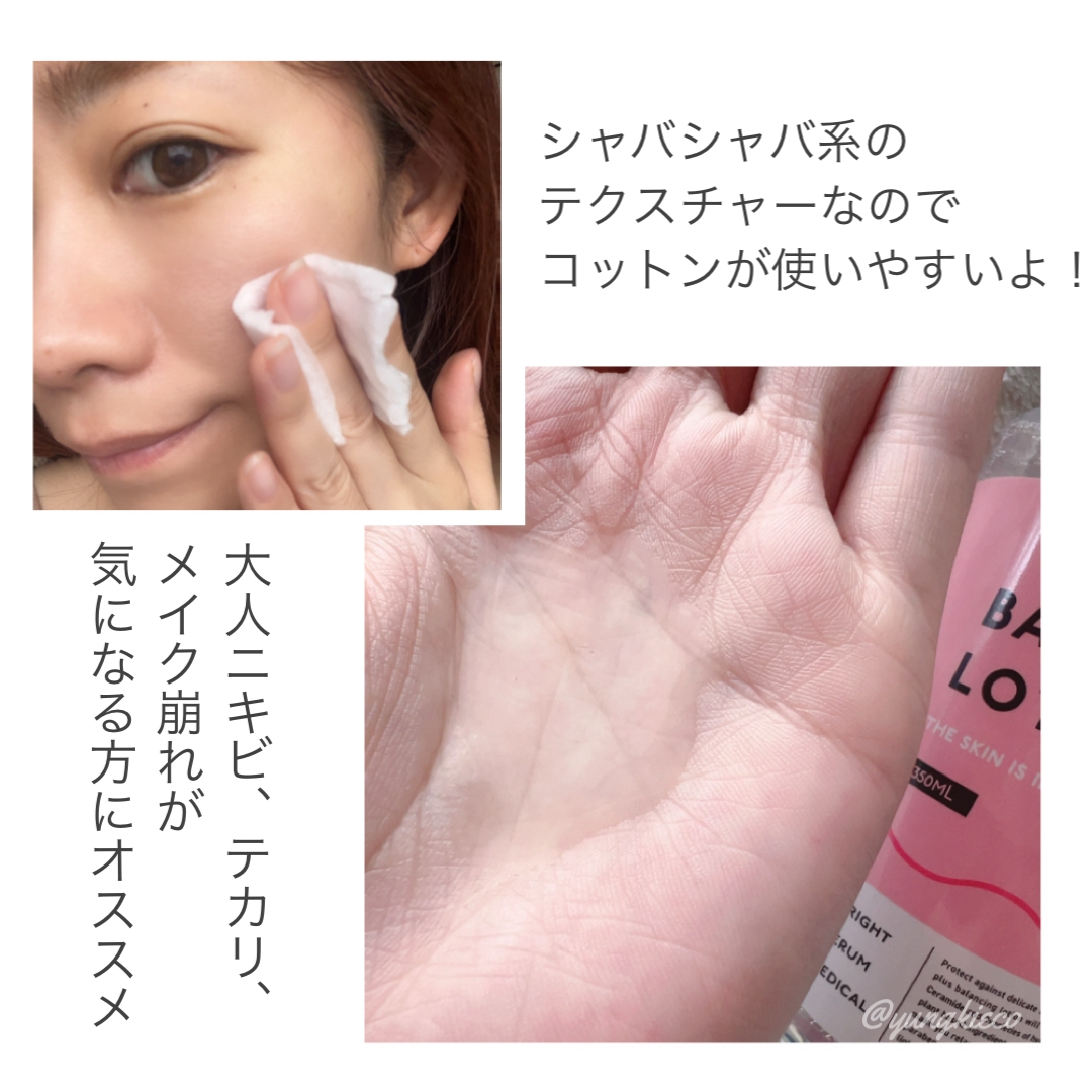 akaran+(アカランプラス) バランシングローションの良い点・メリットに関するyungさんの口コミ画像2
