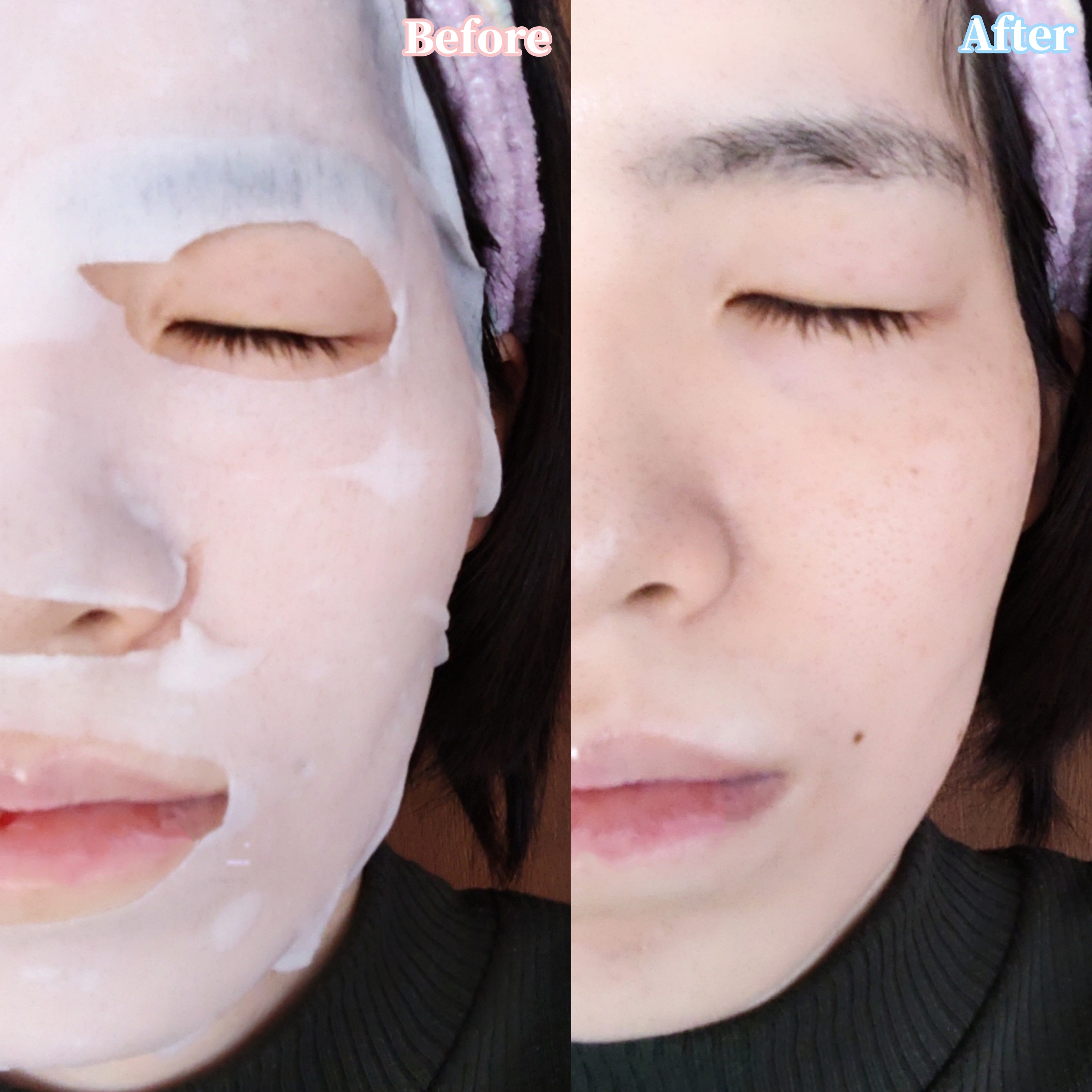 C VITAS Cフォーカスマスクを使ったYuKaRi♡さんのクチコミ画像5