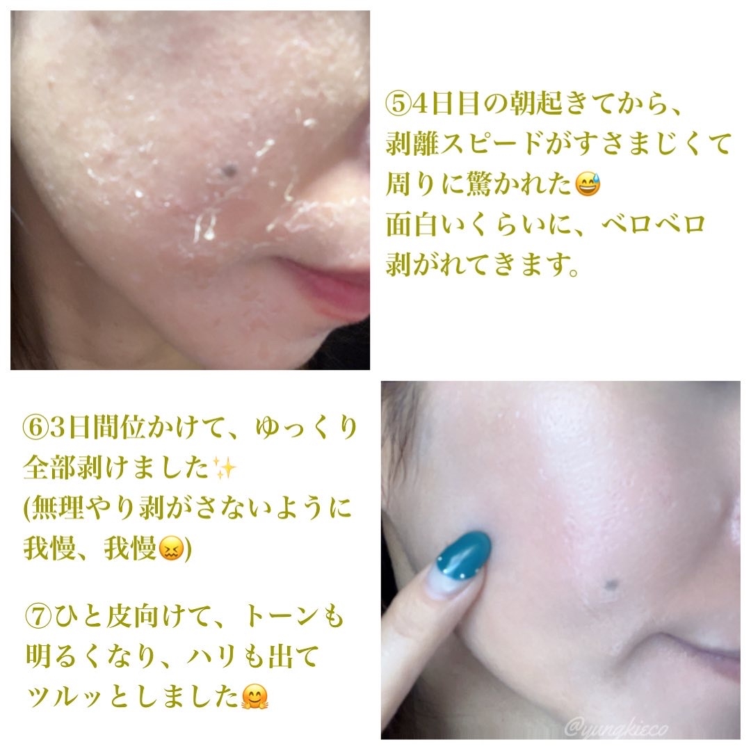 BQCELL DERMA SKIN PEELINGビーキューセル DスキンP - beaconparenting.ie