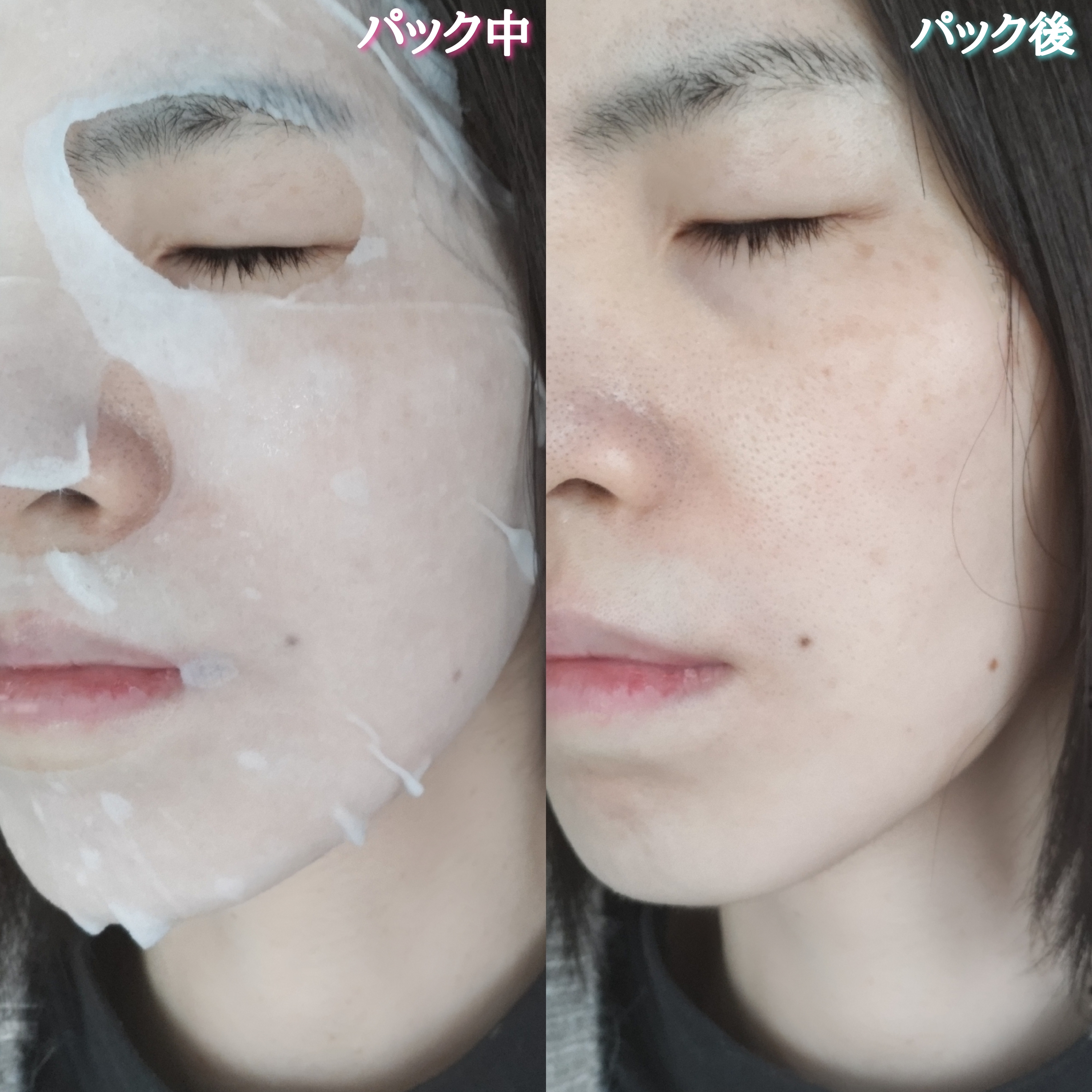 PANACÈE TOKYO モイストチャージ Cマスクを使ったYuKaRi♡さんのクチコミ画像6
