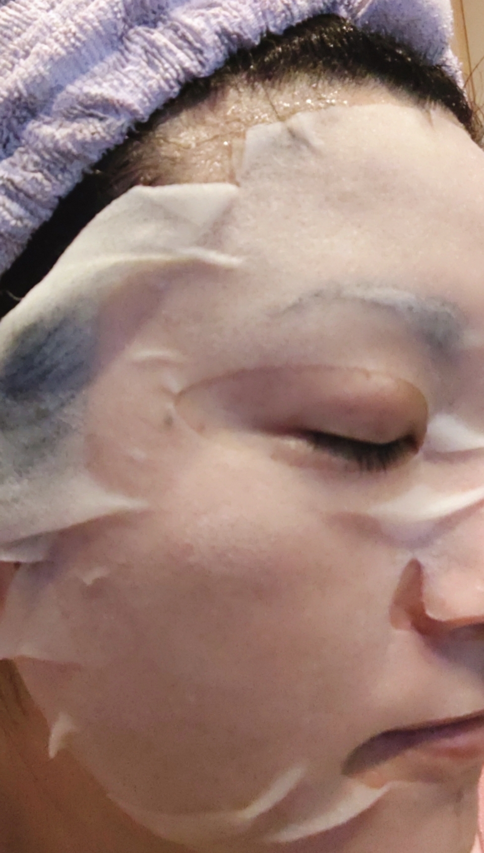 Arouge(アルージェ) スキントラブルケアマスクを使った恵未さんのクチコミ画像5