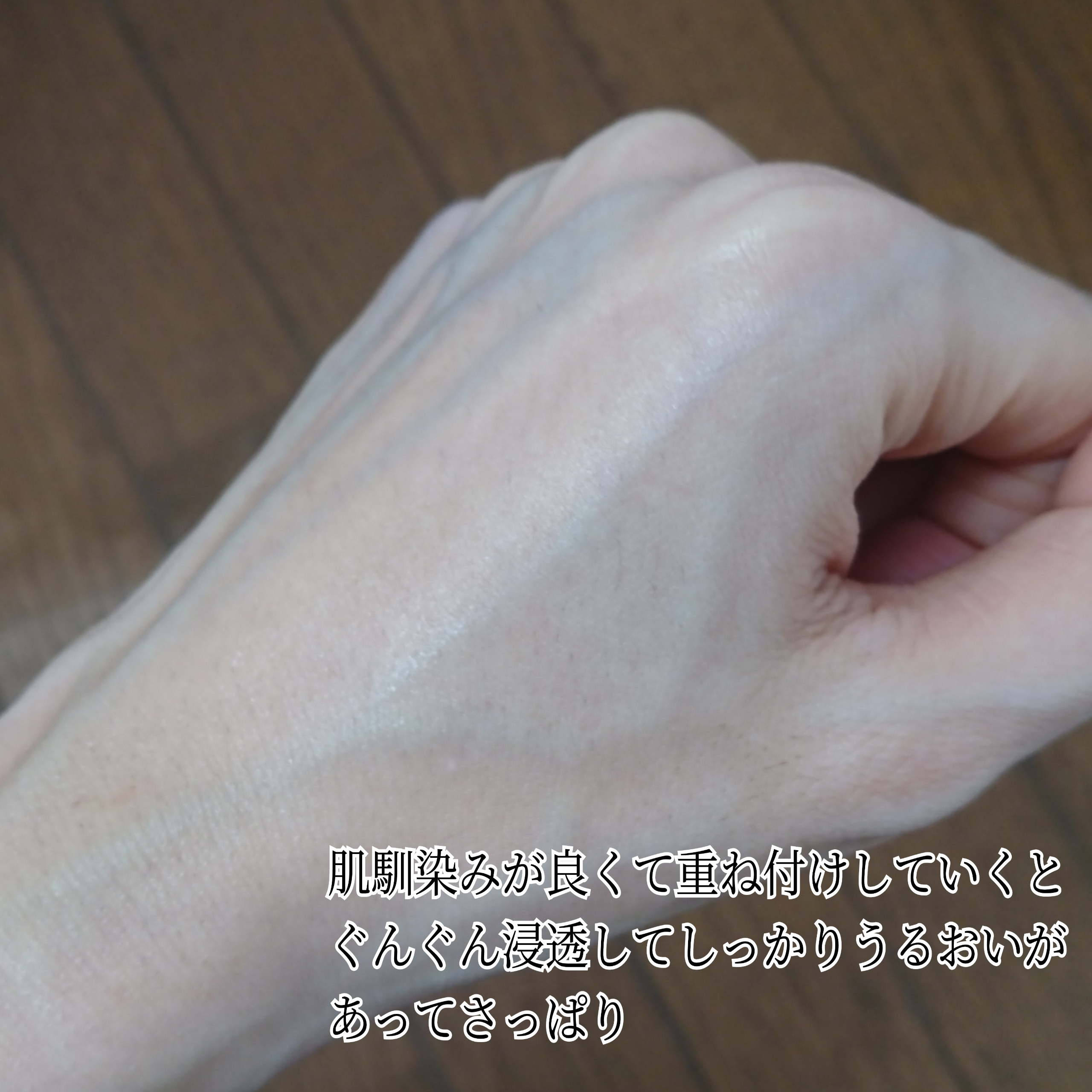 ユーガ Tea Tree Skin Lotionを使ったYuKaRi♡さんのクチコミ画像5